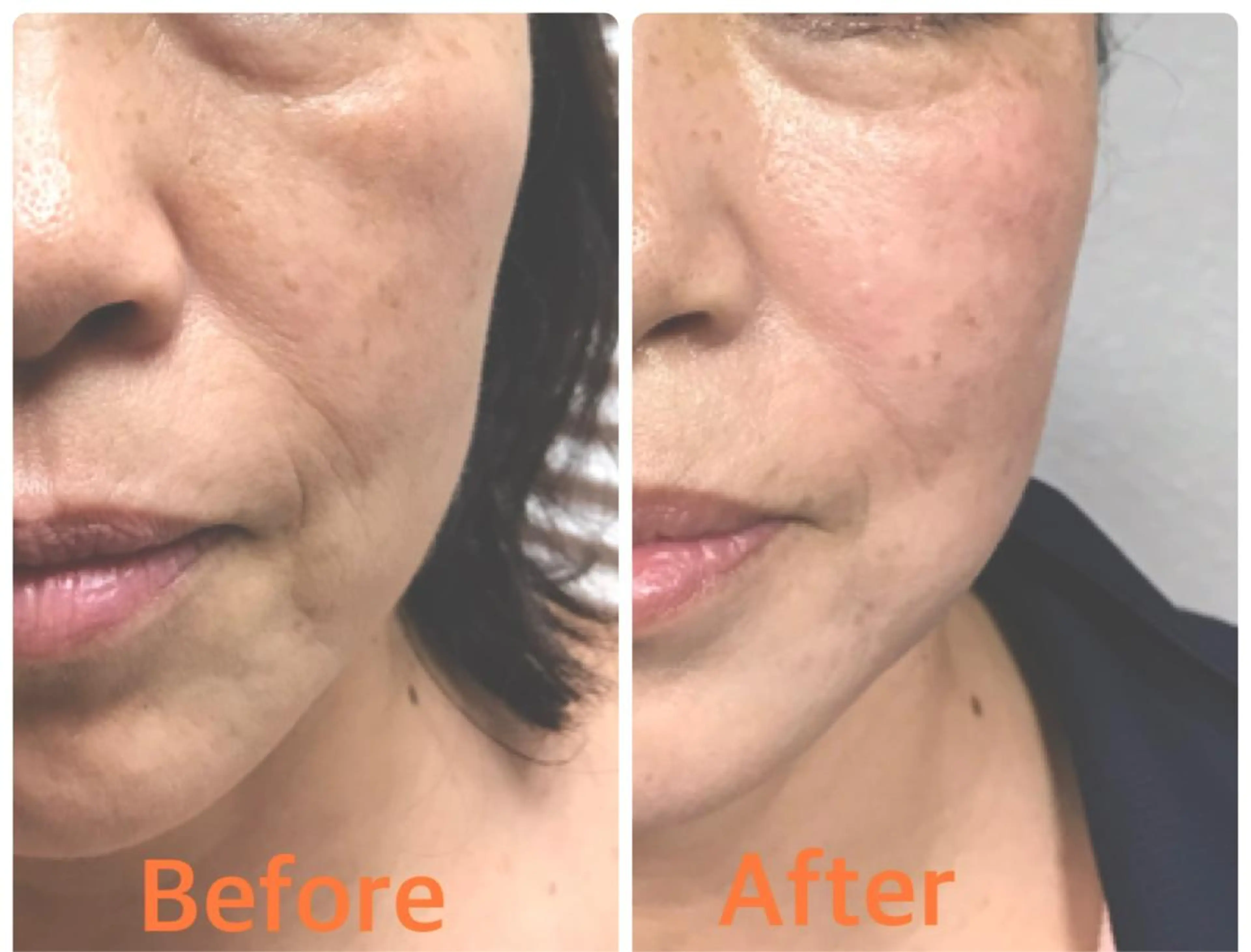 横浜ビューティーファクトリーHANA元町店所属・エステ＆アロマ HANAのエステ・リラクイメージ