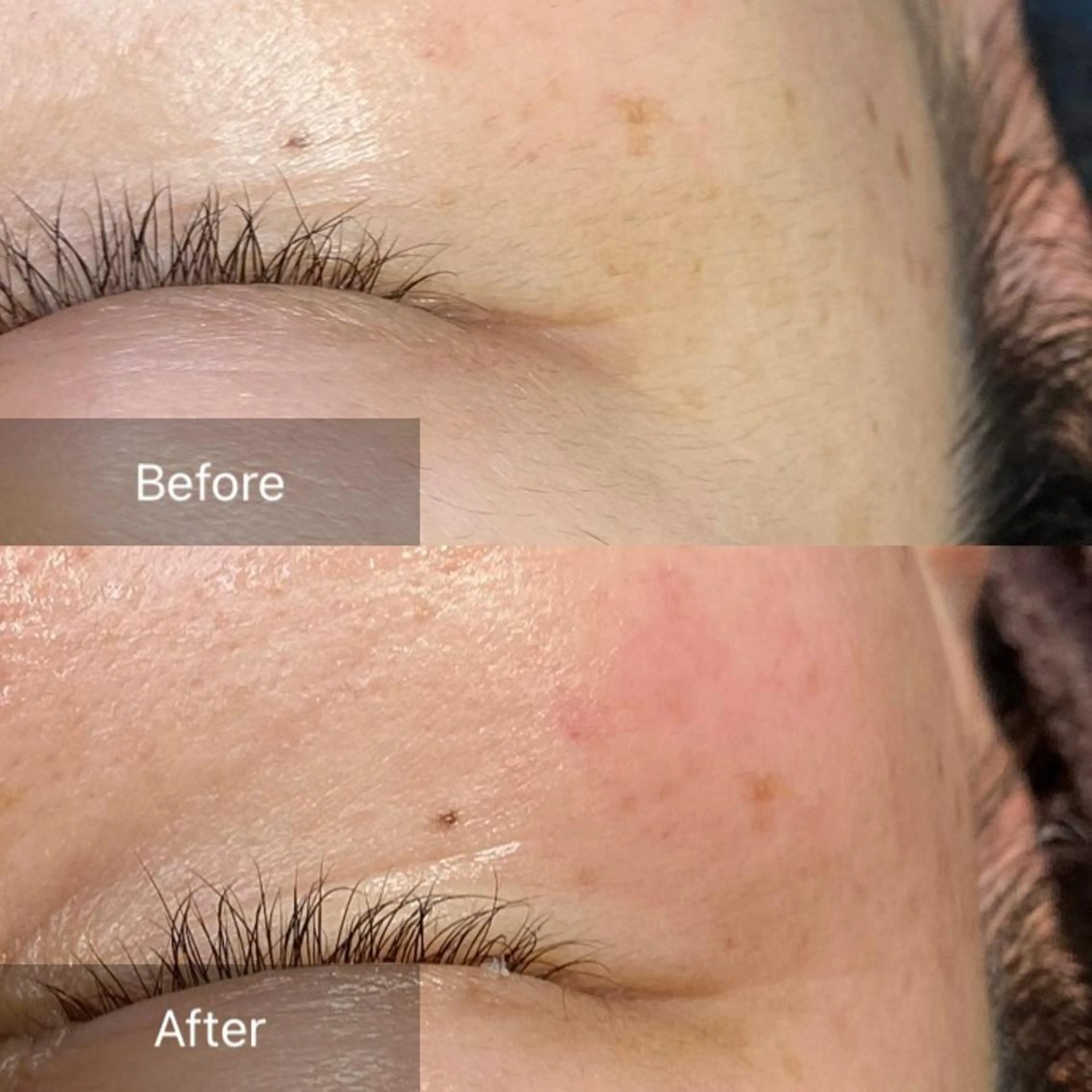 脱毛 産毛専門店 Bittoのエステ・リラクイメージ