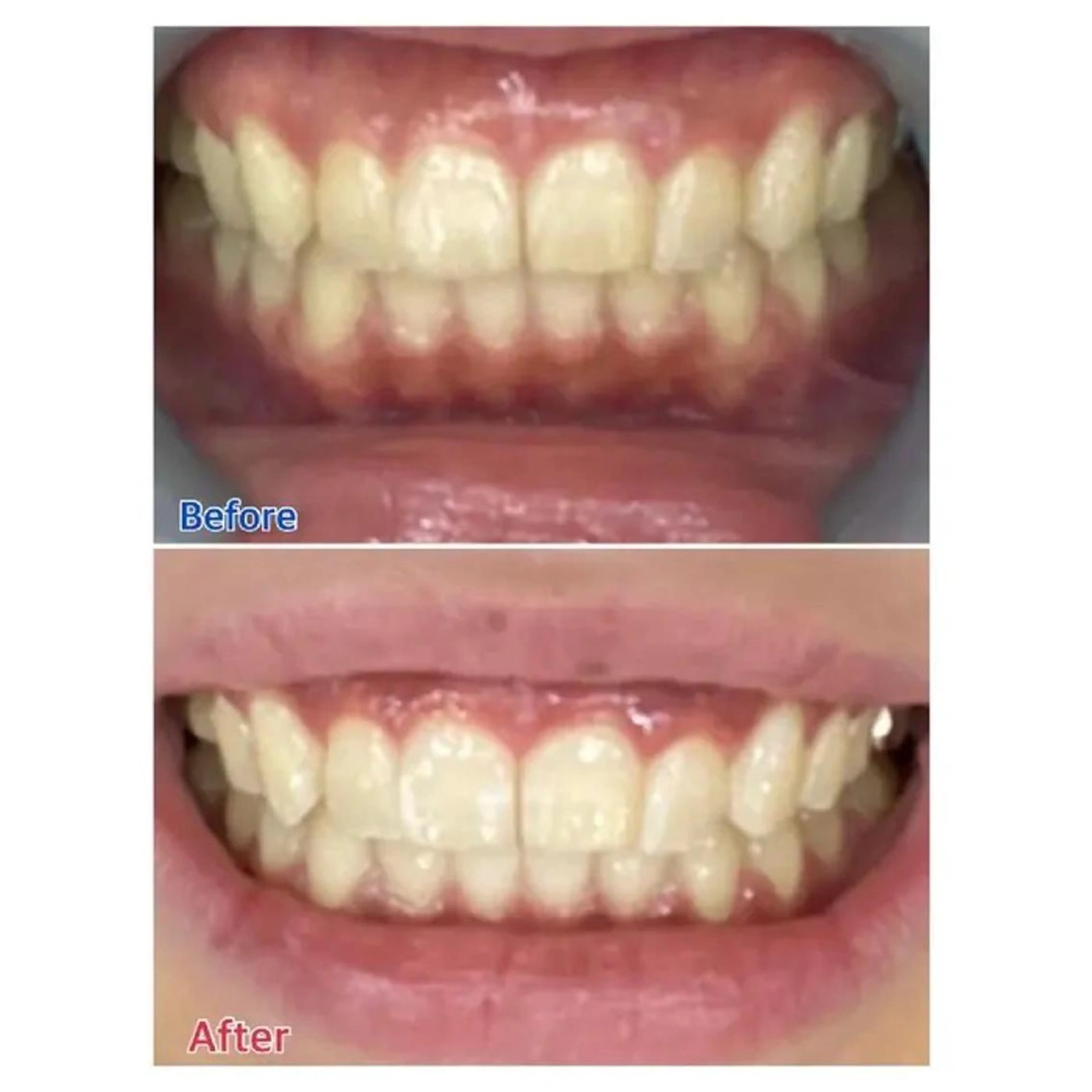 M渋谷 ホワイトニングのエステ・リラクイメージ