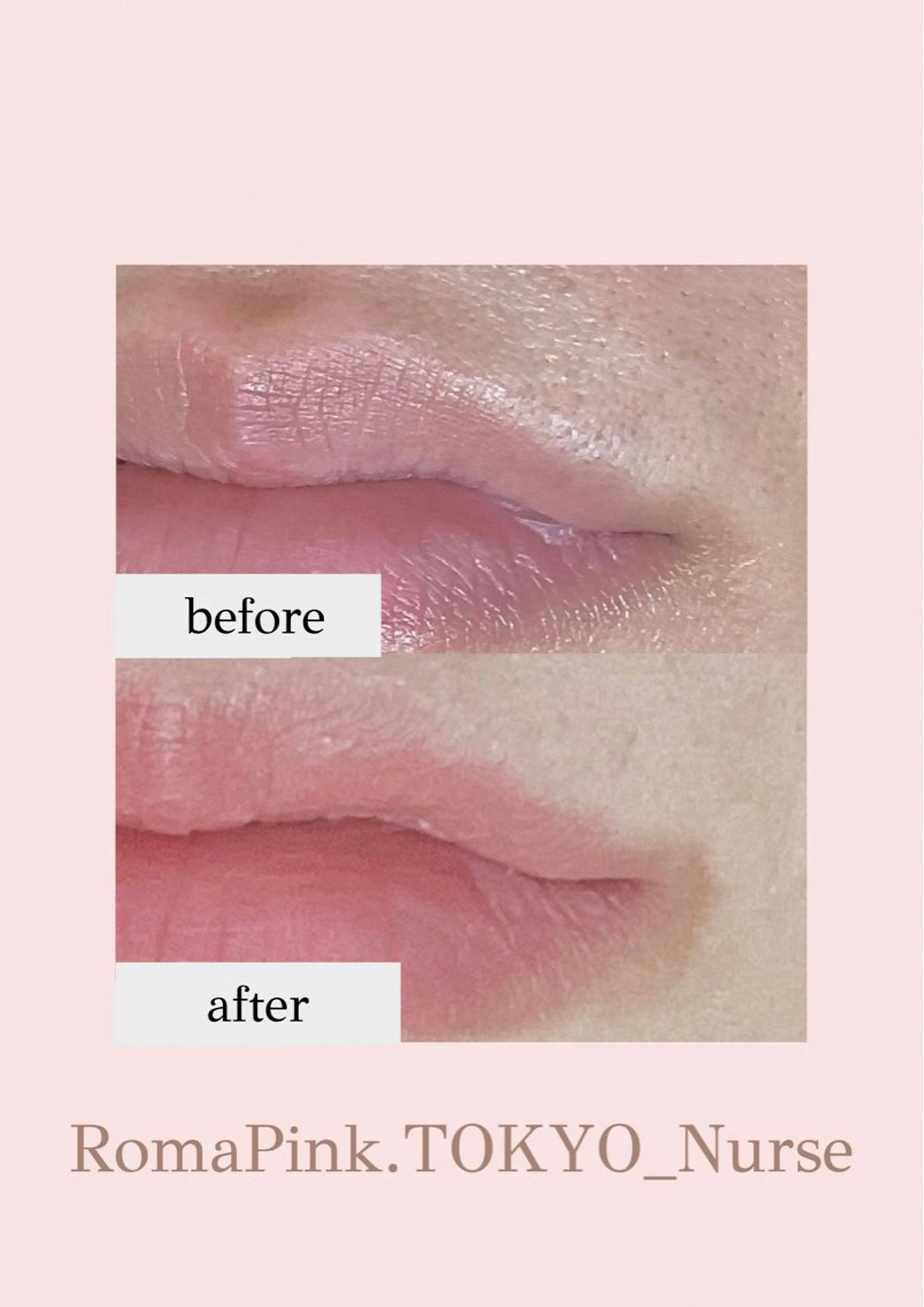 その他 看護師 AYUIのエステ・リラクイメージ