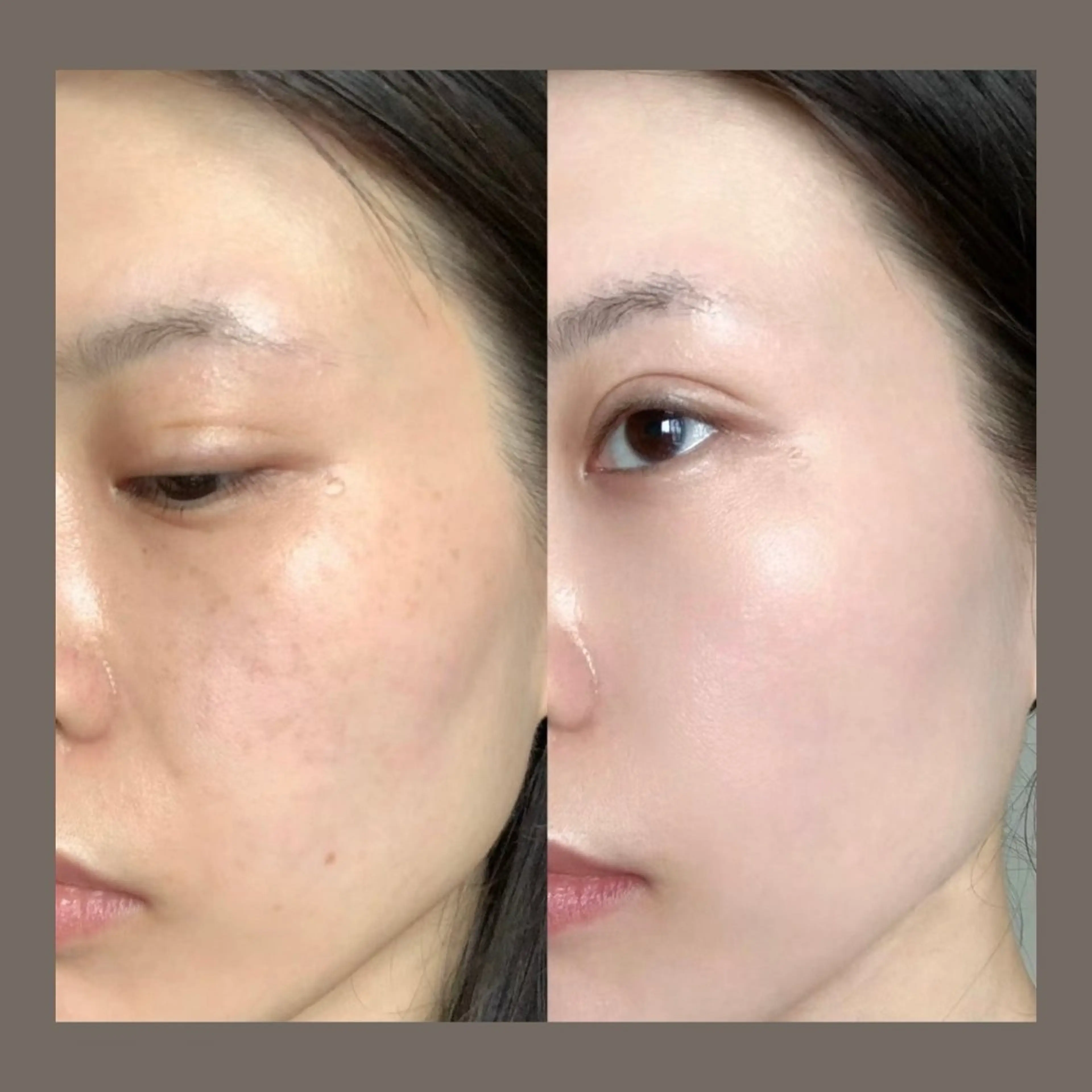 エステ リラク 愛維美水光美肌専門店所属・愛維美水光美肌専門店 メンズレディースokのエステ・リラクイメージ