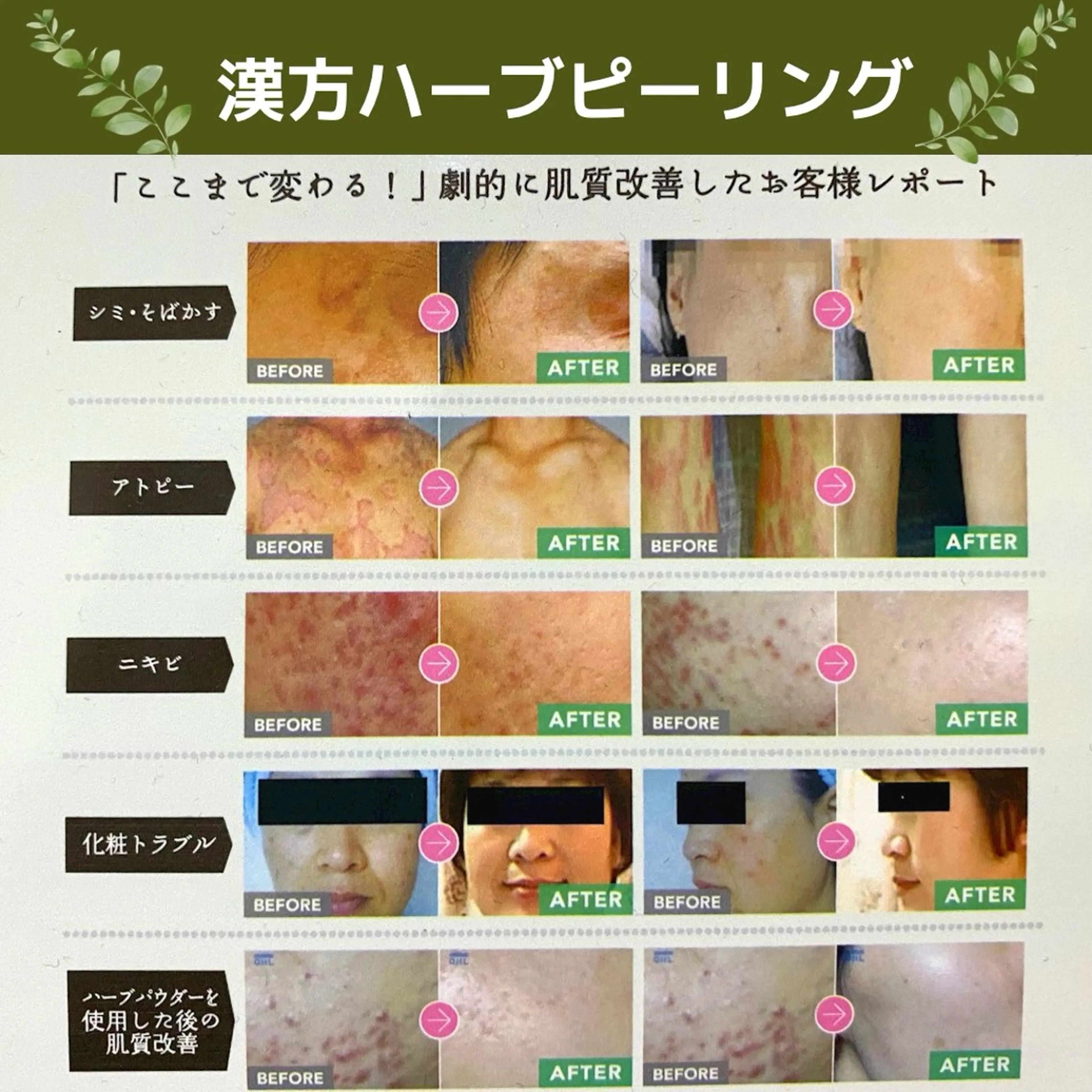 エステ よもぎ蒸しサロン ゆんのエステ・リラクイメージ