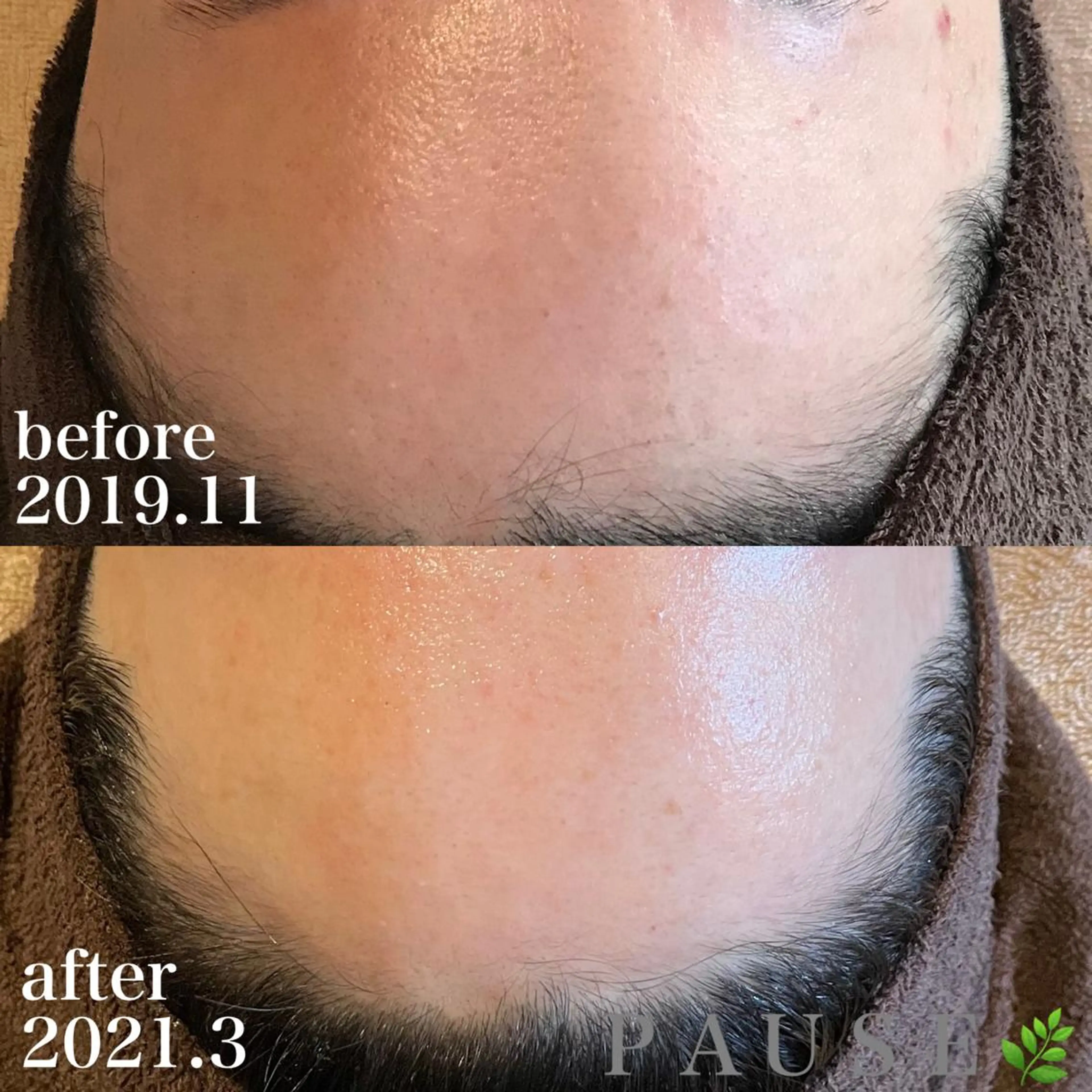 エステ 浜野 恵美のエステ・リラクイメージ