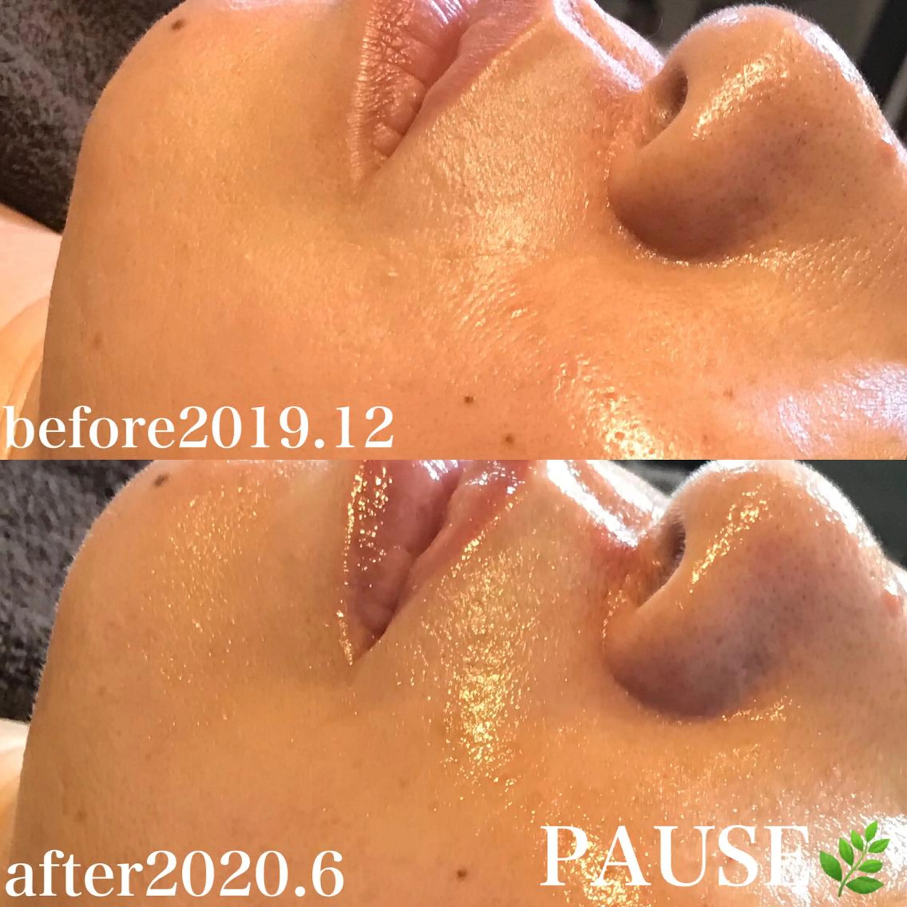 エステ 浜野 恵美のエステ・リラクイメージ