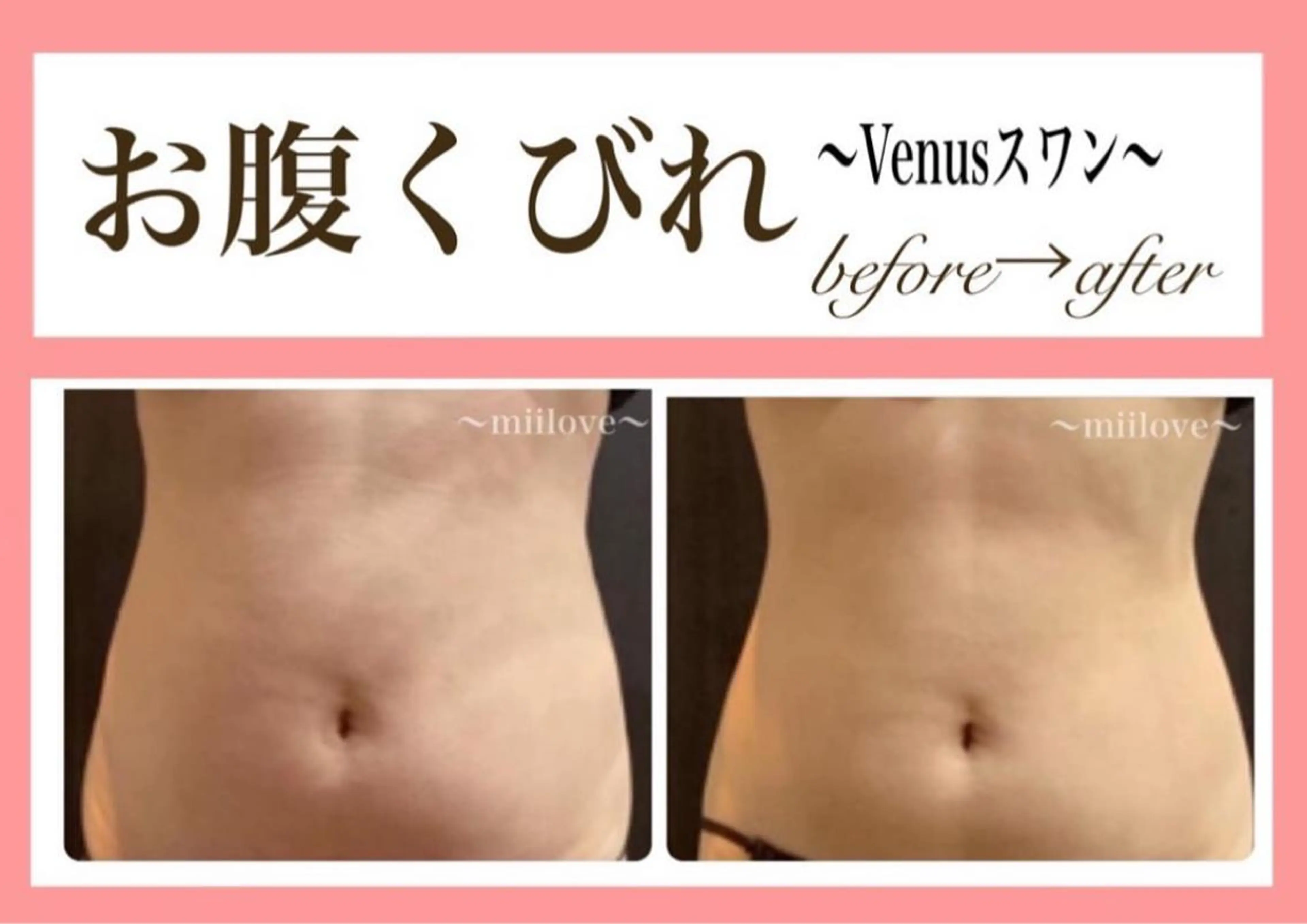 miilove 鹿児島店のエステ・リラクイメージ