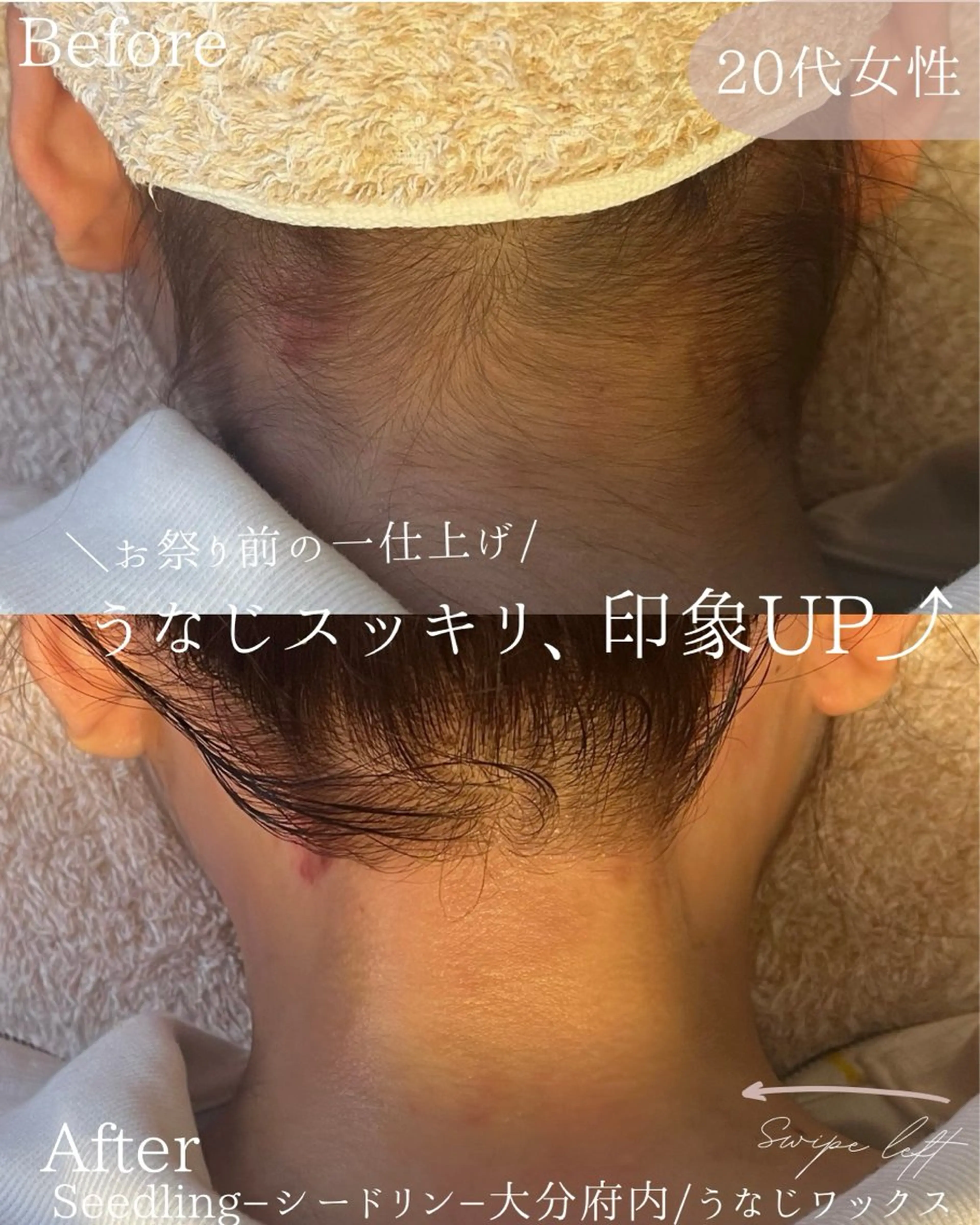 脱毛 シードリン 府内店 小波のヘアスタイル