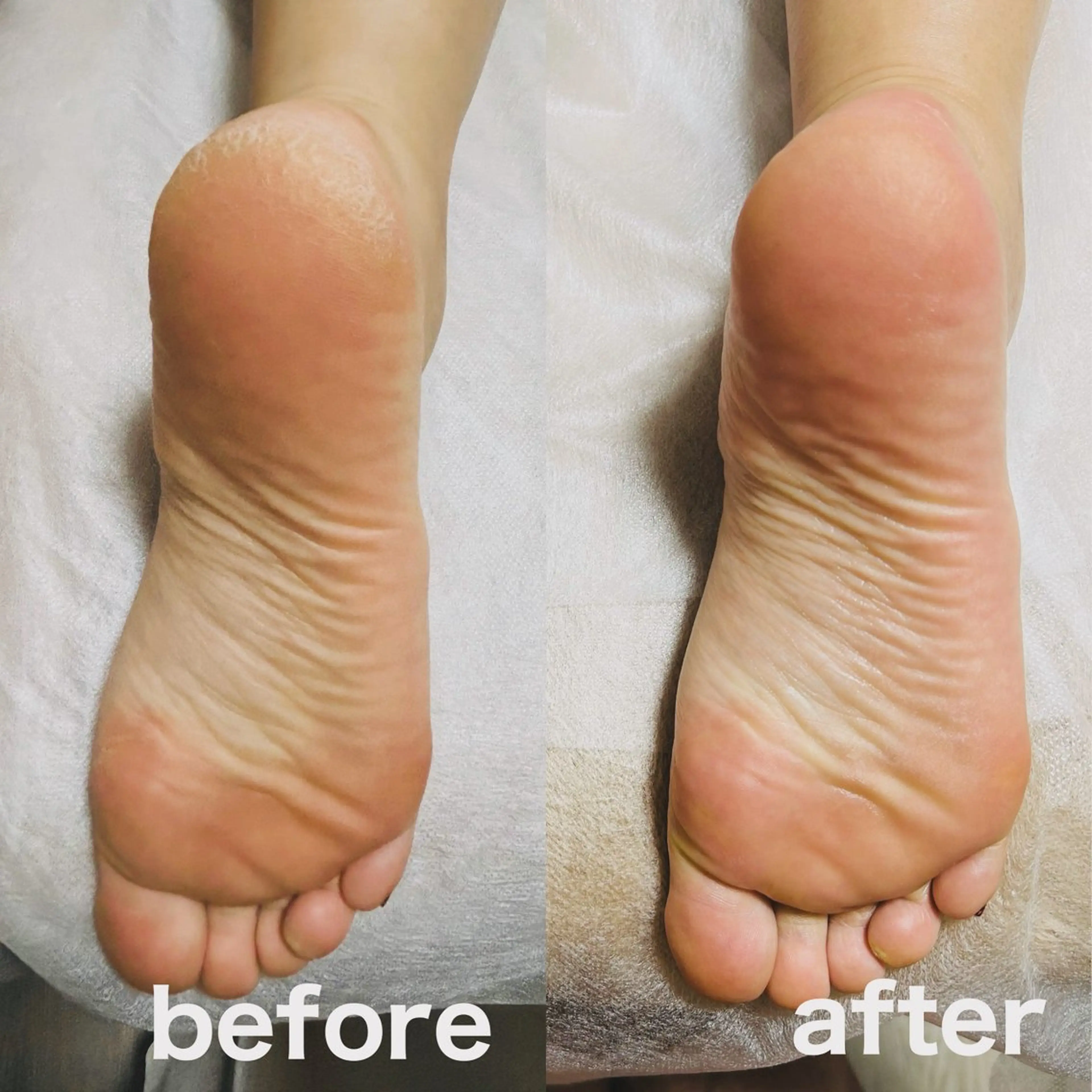 その他 フットケアサロン Kotoriのその他イメージ