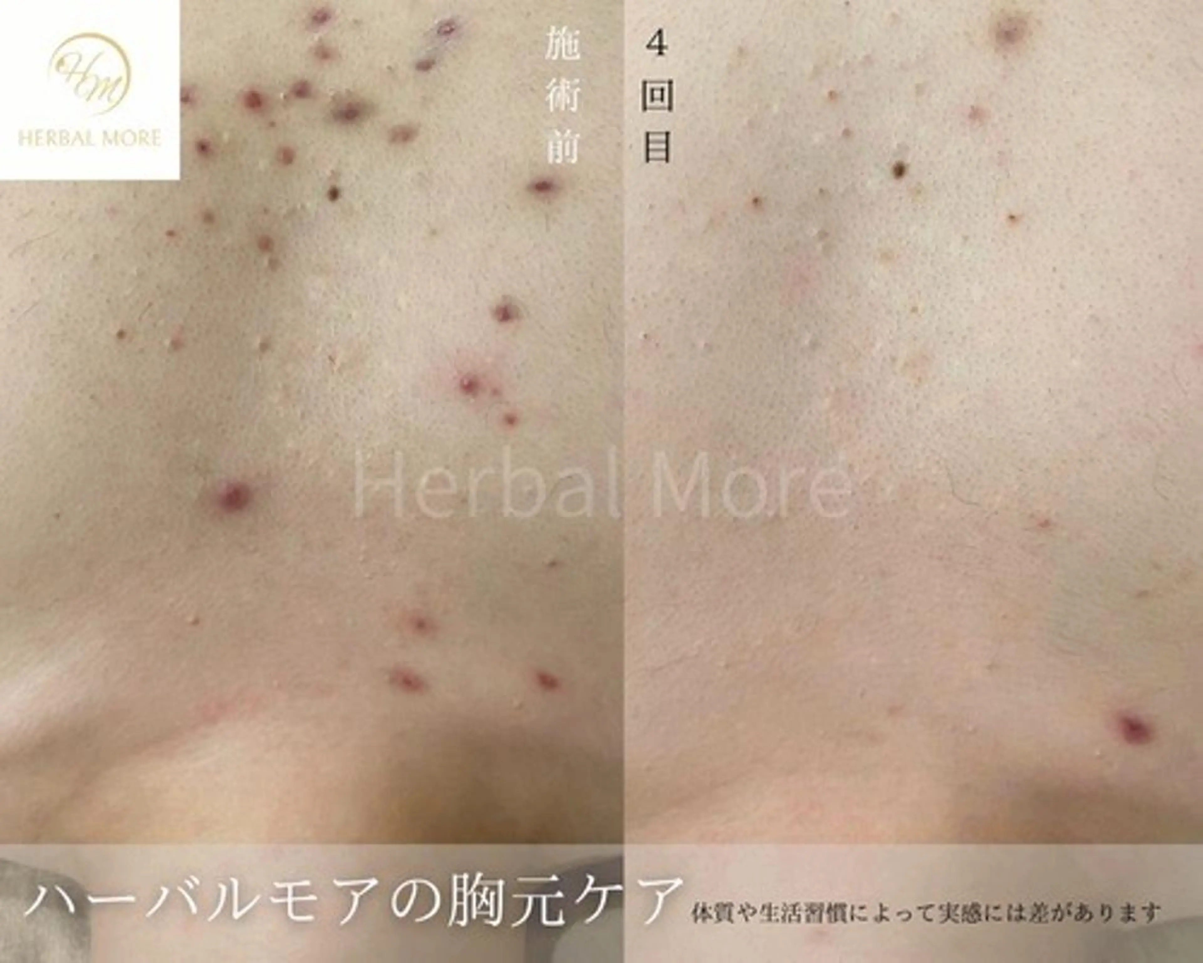 脱毛・眉毛・フェイス サロンN久留米店の眉毛・アイブロウイメージ