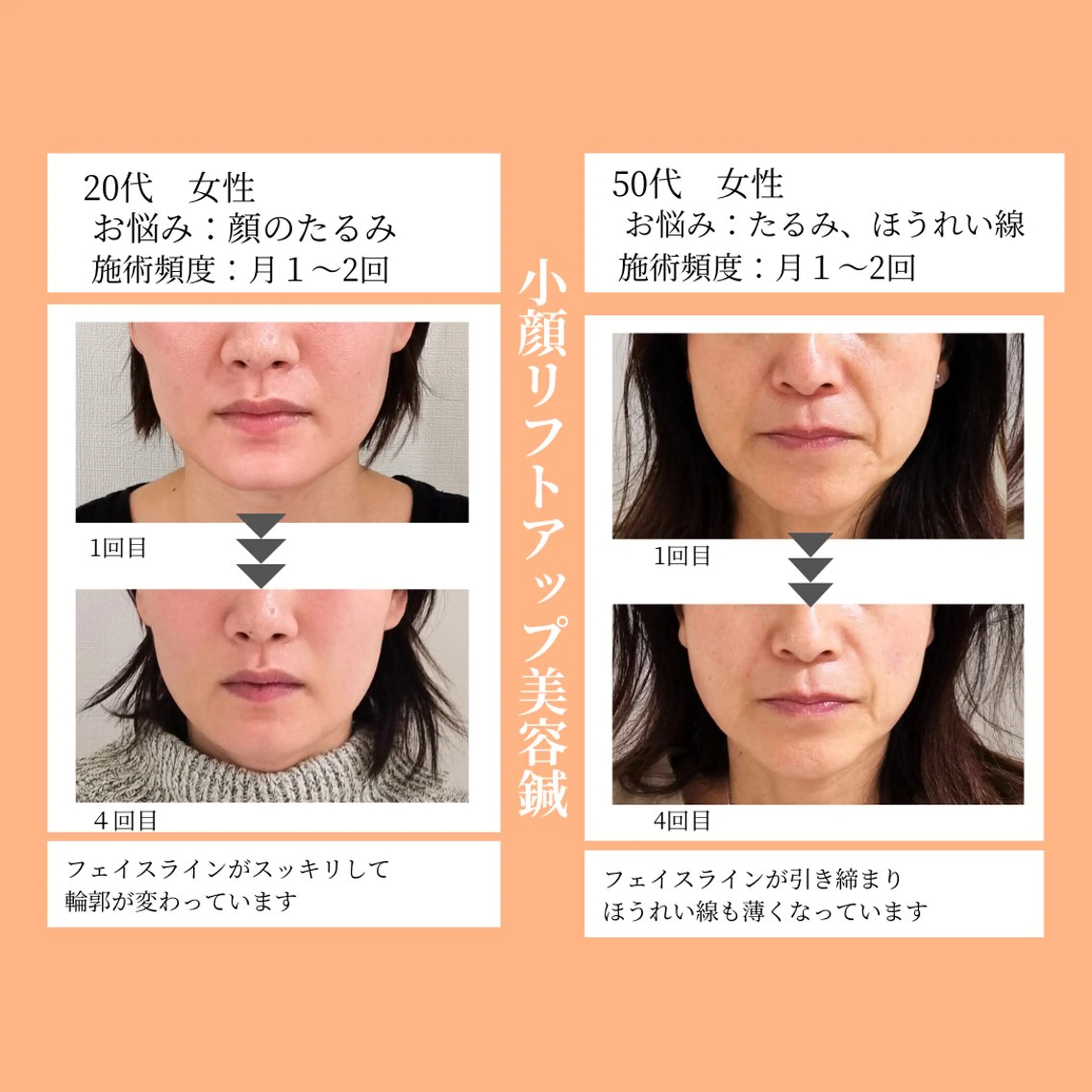 小顔・ツルツル素肌 ハリステリアのエステ・リラクイメージ