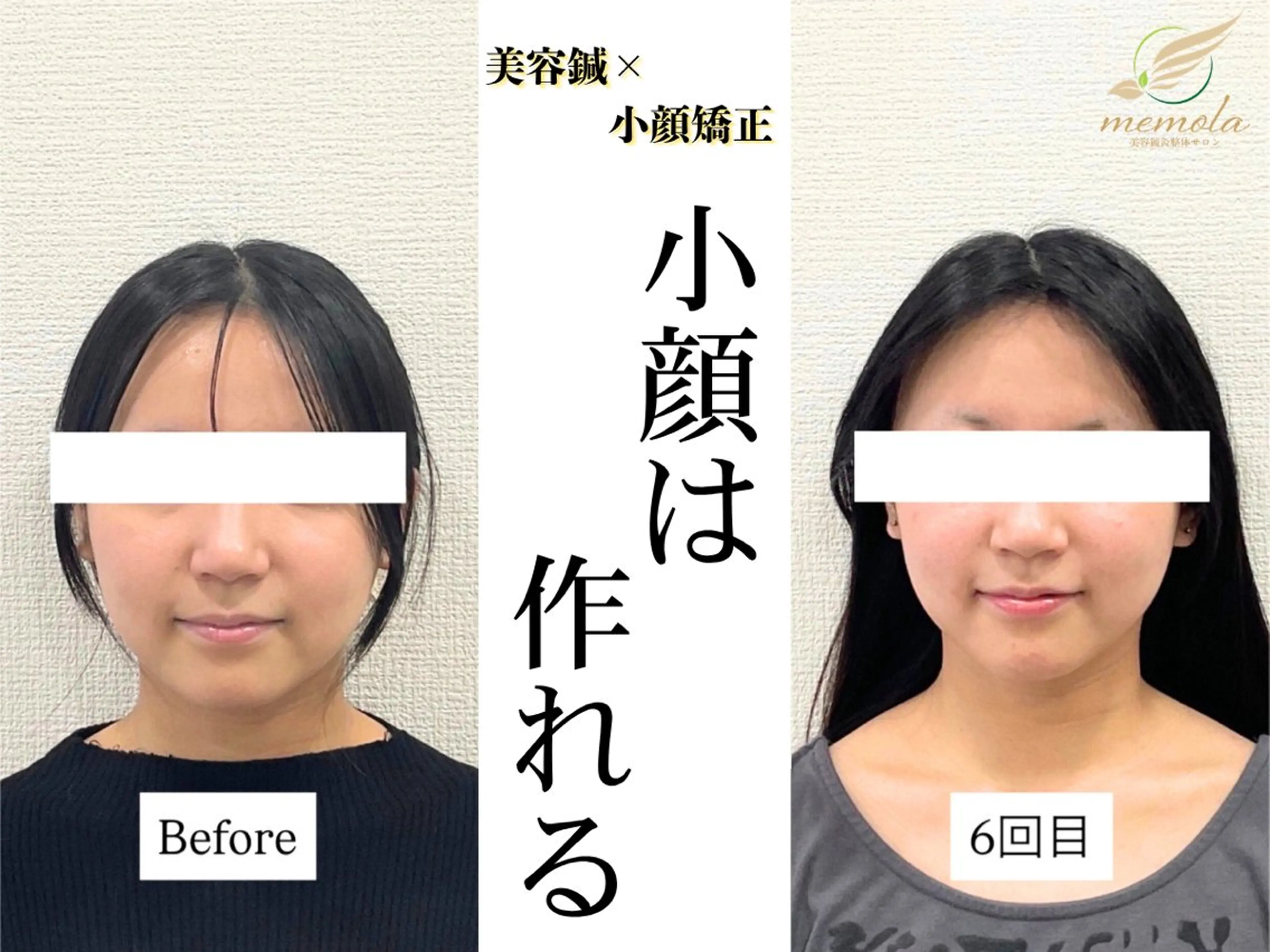 リラク 美容鍼×小顔×整体× ブライダル 大阪梅田のエステ・リラクイメージ