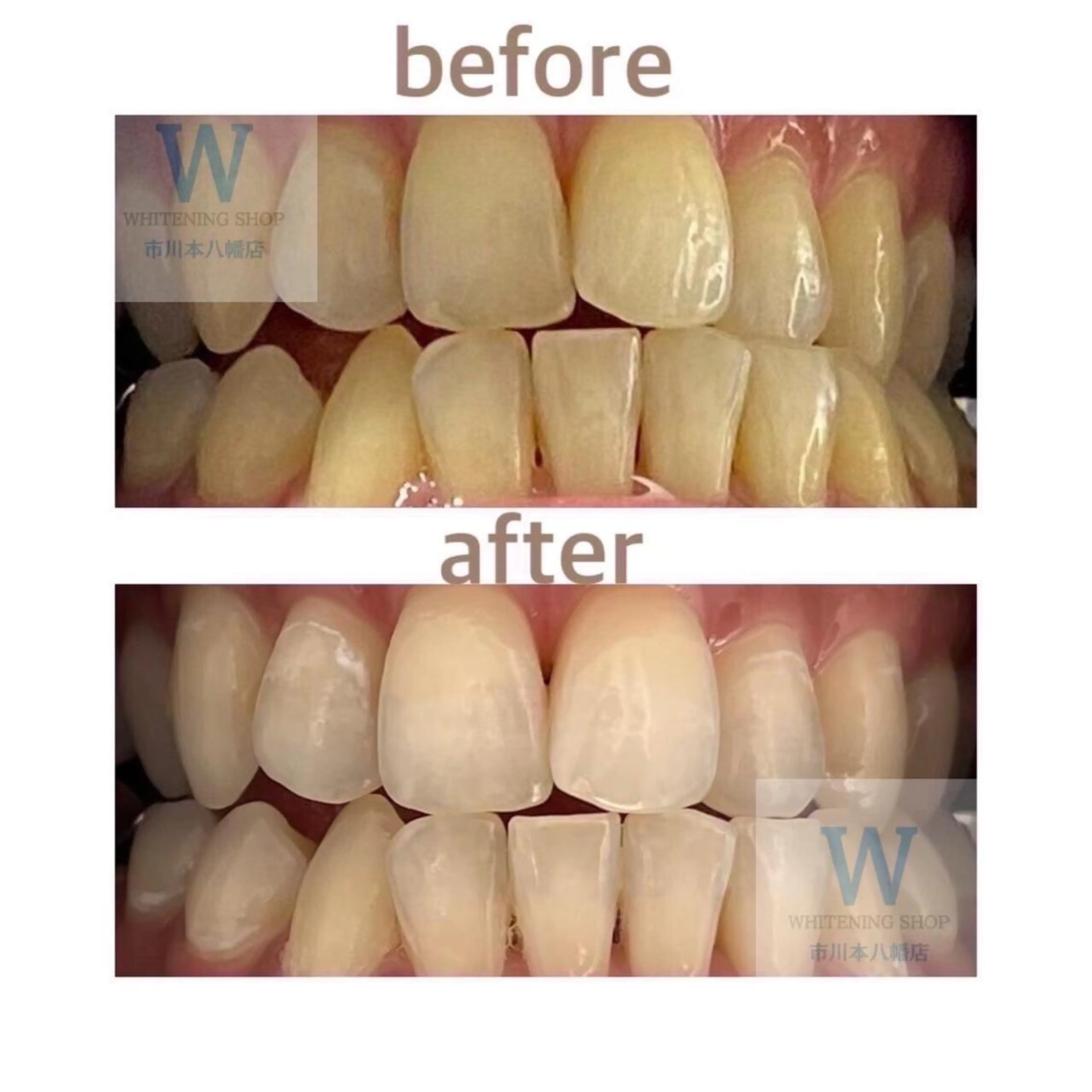 ホワイトニング ショップ本八幡店のエステ・リラクイメージ