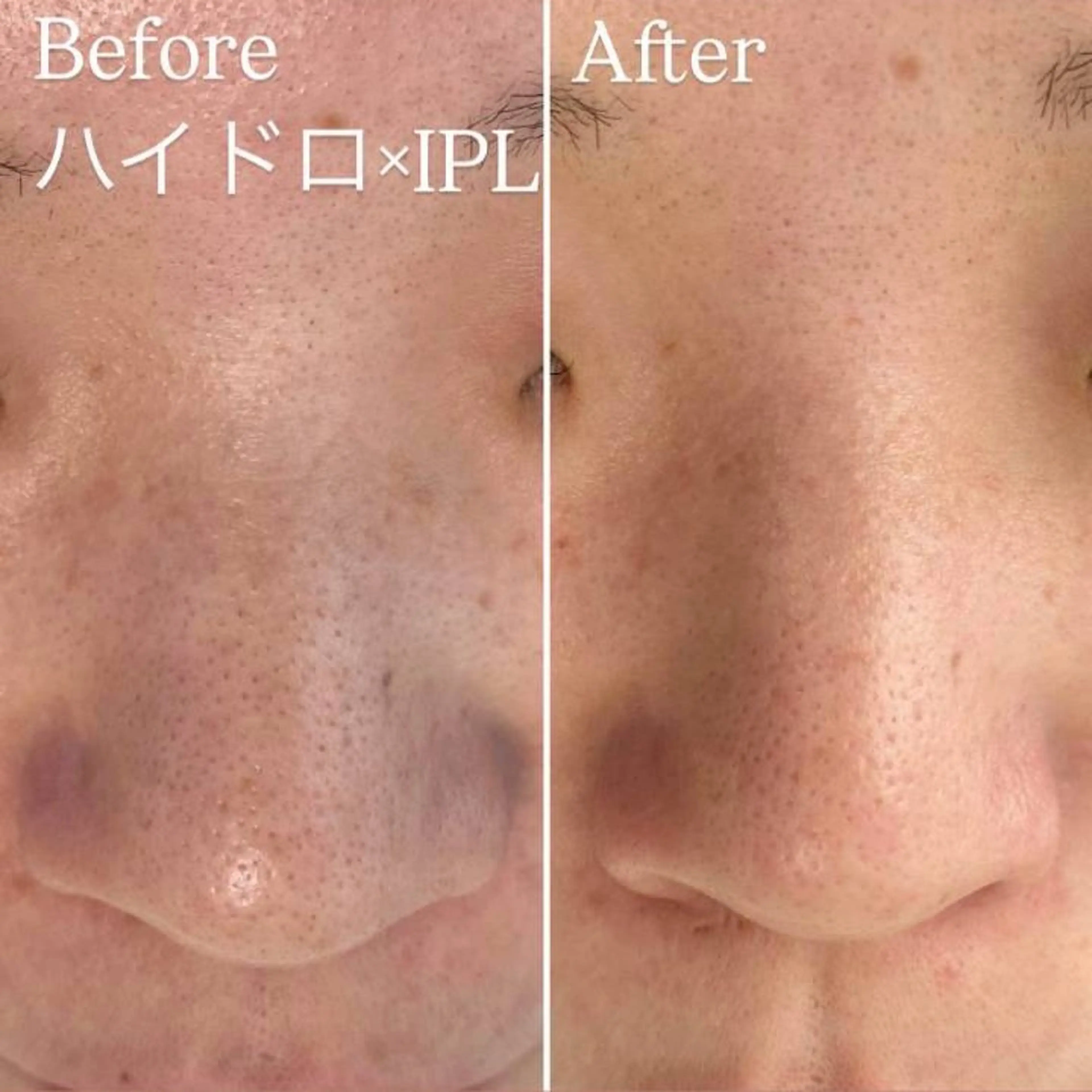 エステ Luv the TERRACEの眉毛・アイブロウイメージ