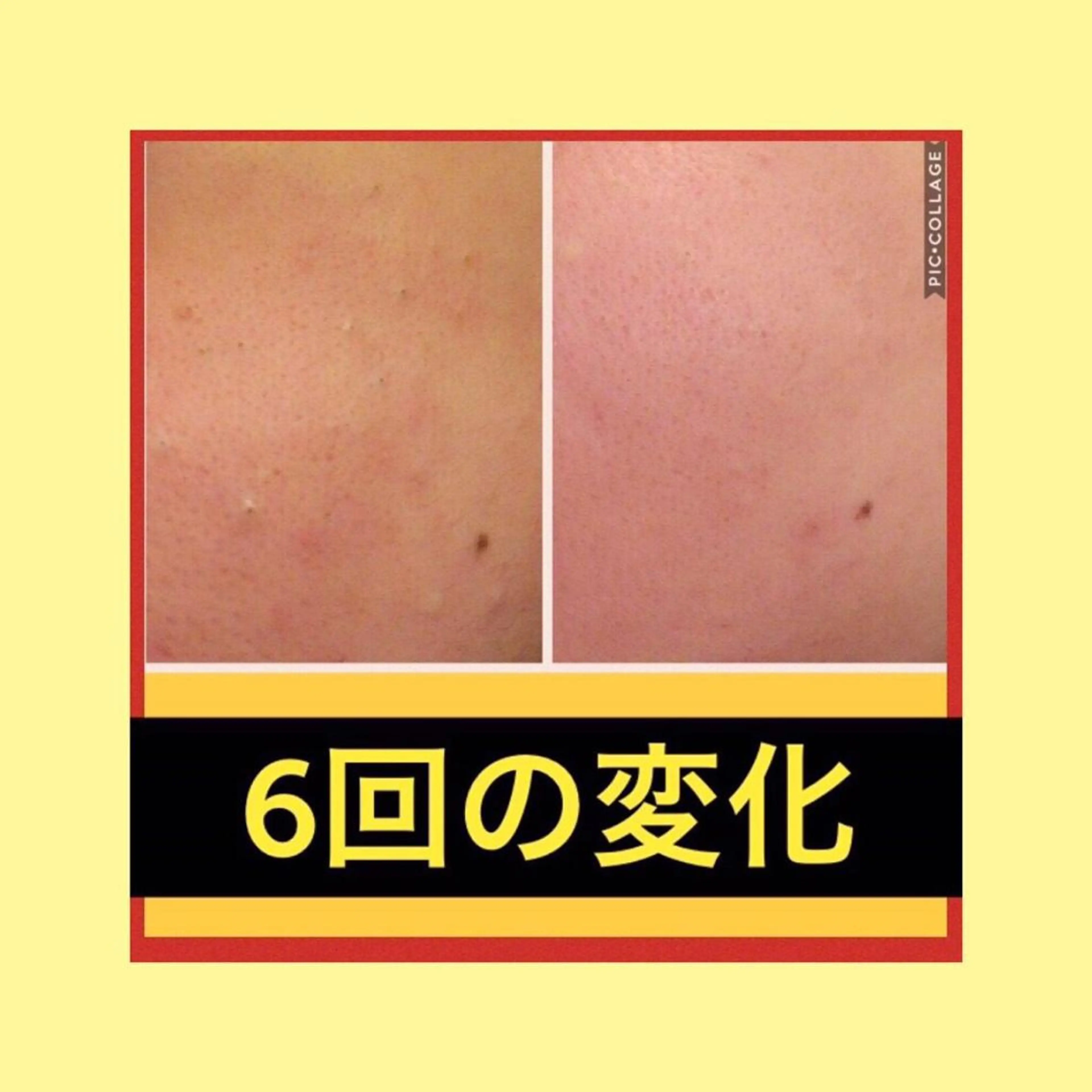 ミディアム パーマ ヘアアレンジ メンズ キッズ ネイル マツエク・マツパ ニキビ・肌質改善専門 ♡人生が変わるサロンのエステ・リラクイメージ