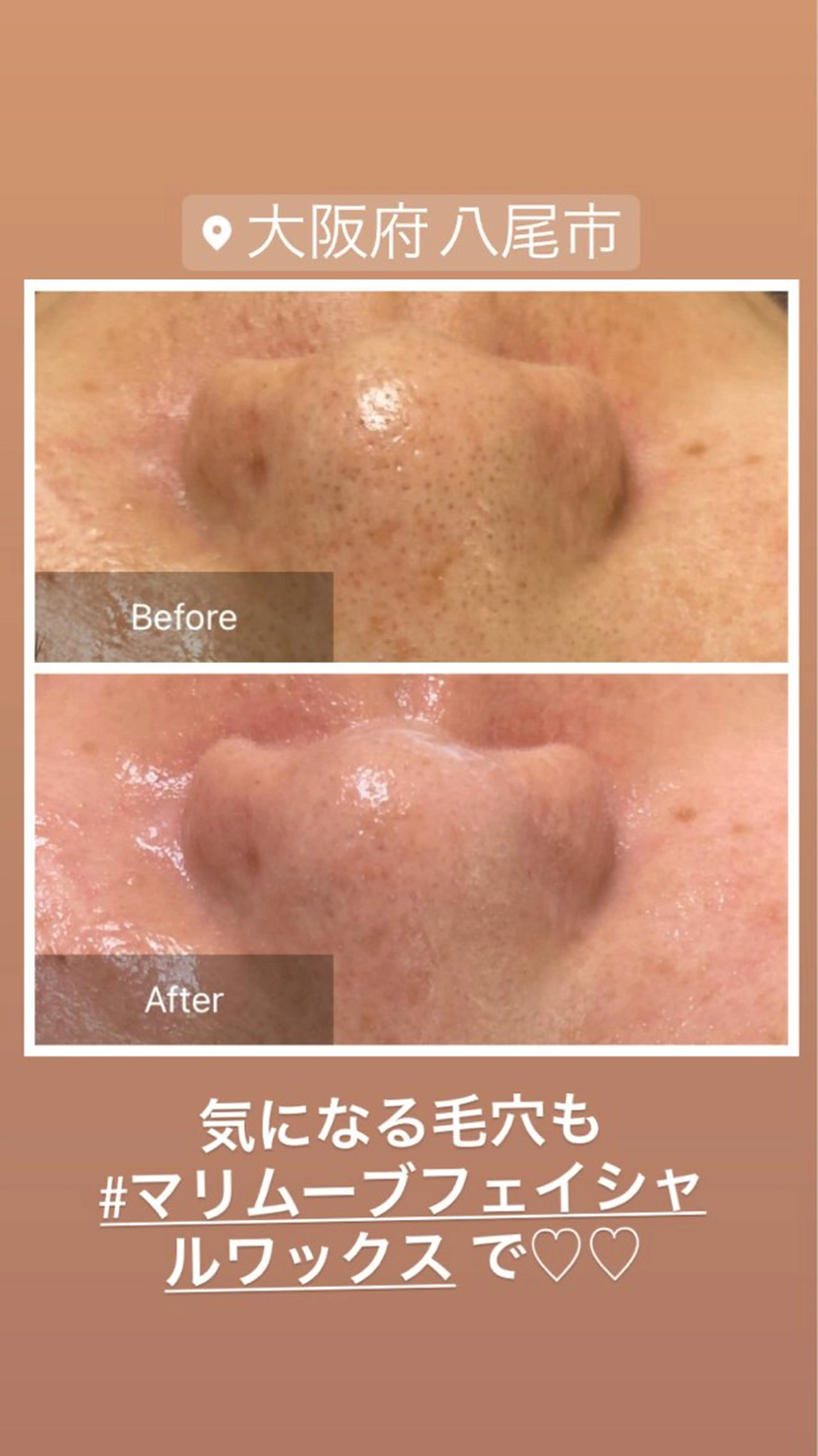 脱毛 産毛専門店 Bittoのエステ・リラクイメージ