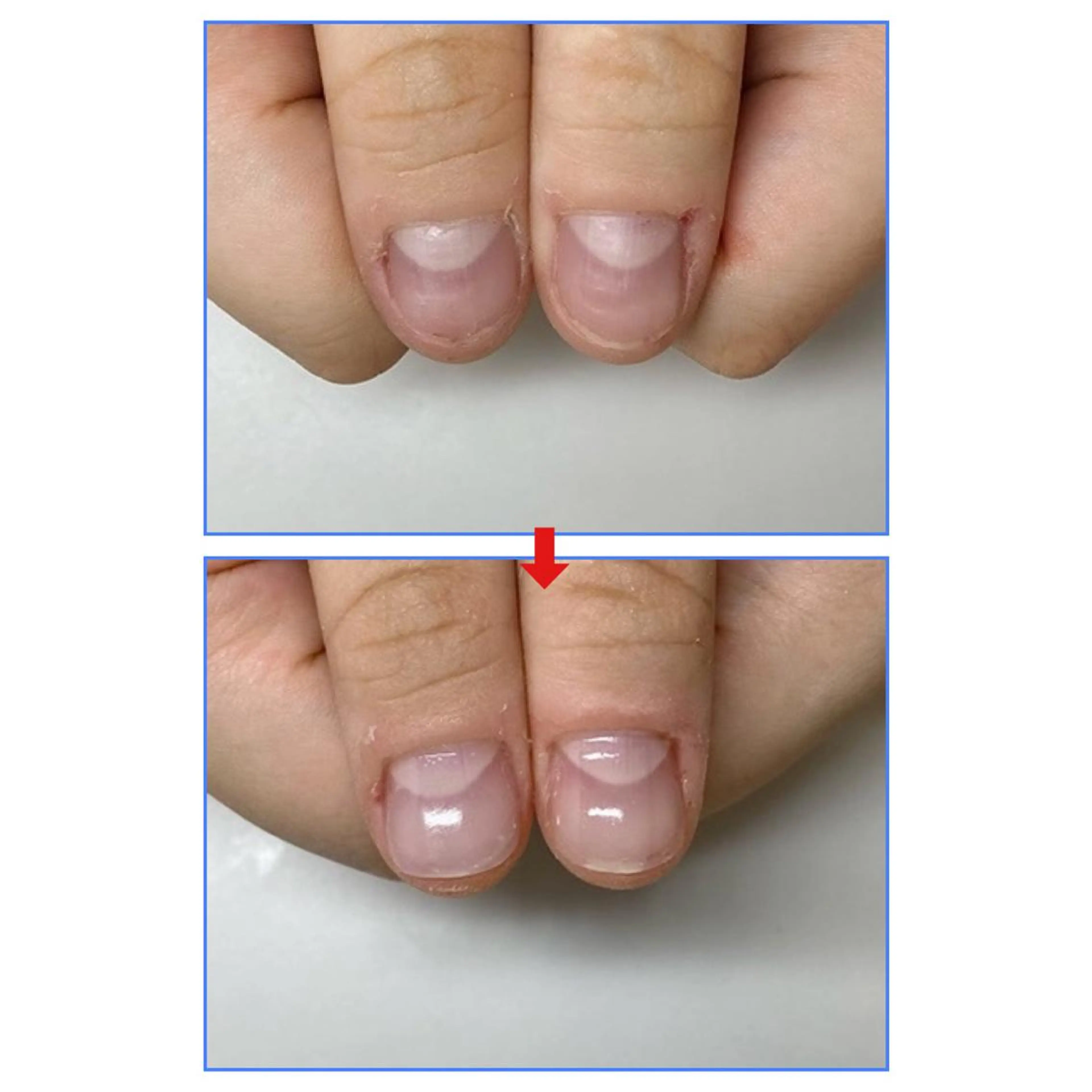 ネイル ネイルサロン アリュームのネイルデザイン