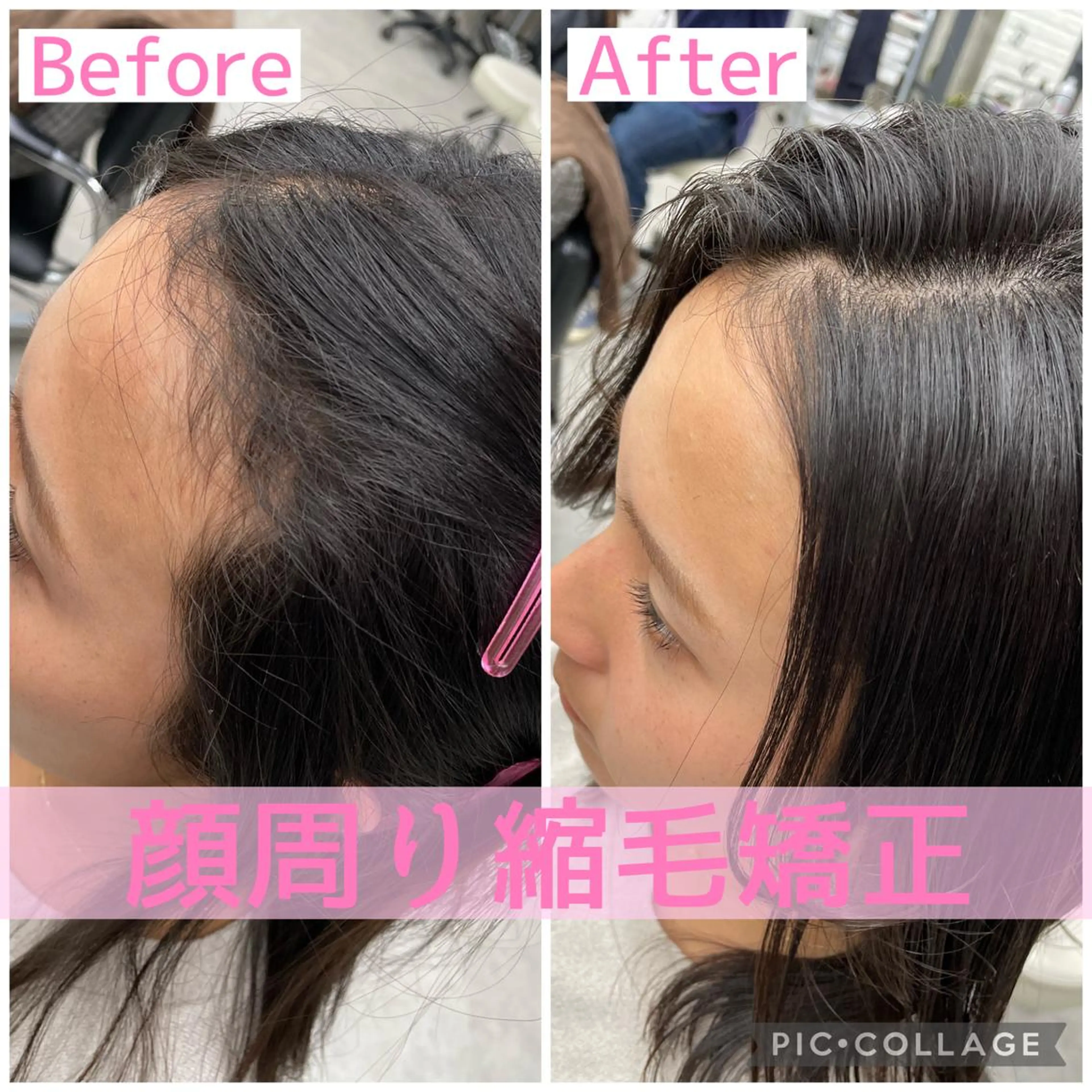 顔周り+前髪の縮毛矯正+超音波トリートメントの写真