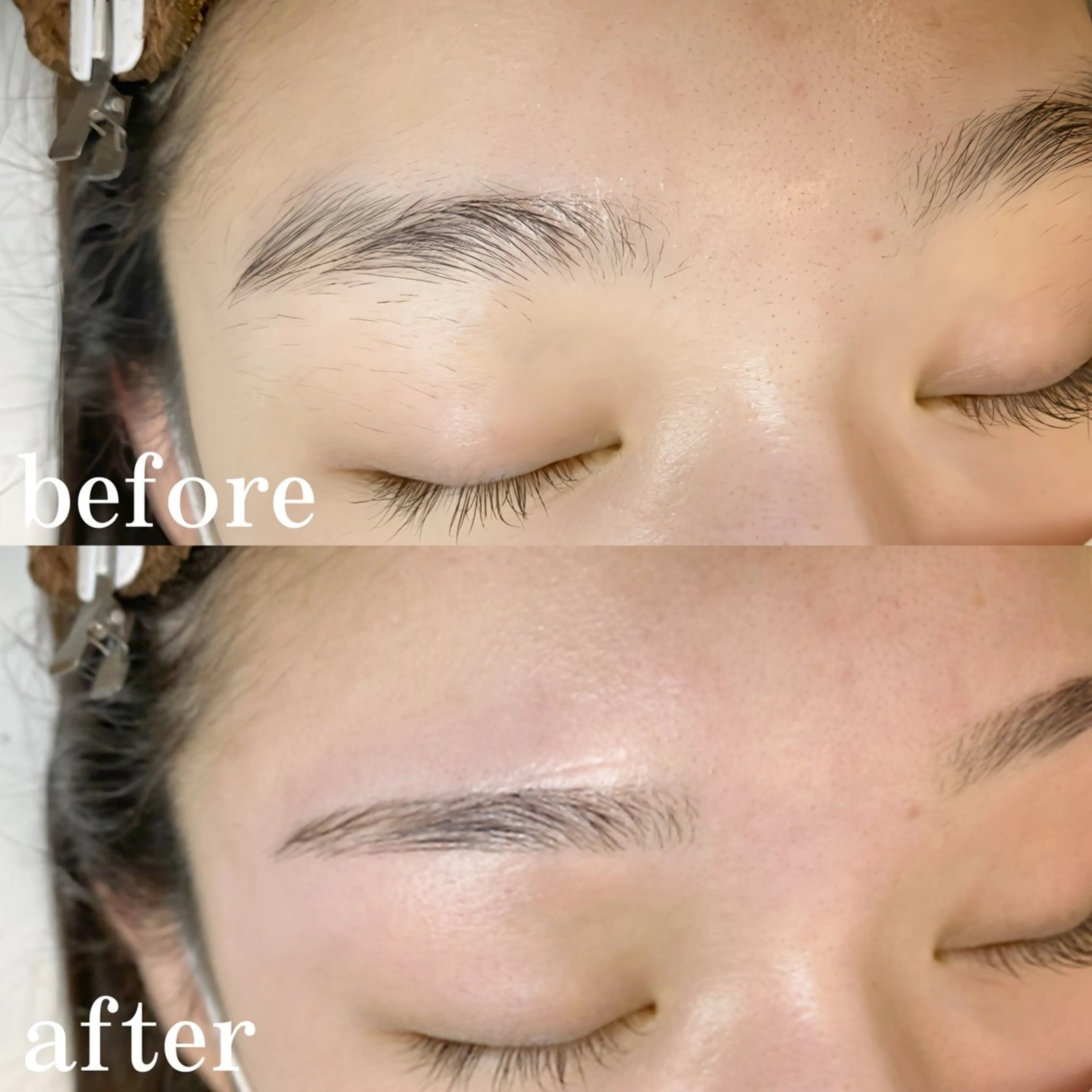 アイブロウワックス脱毛の写真