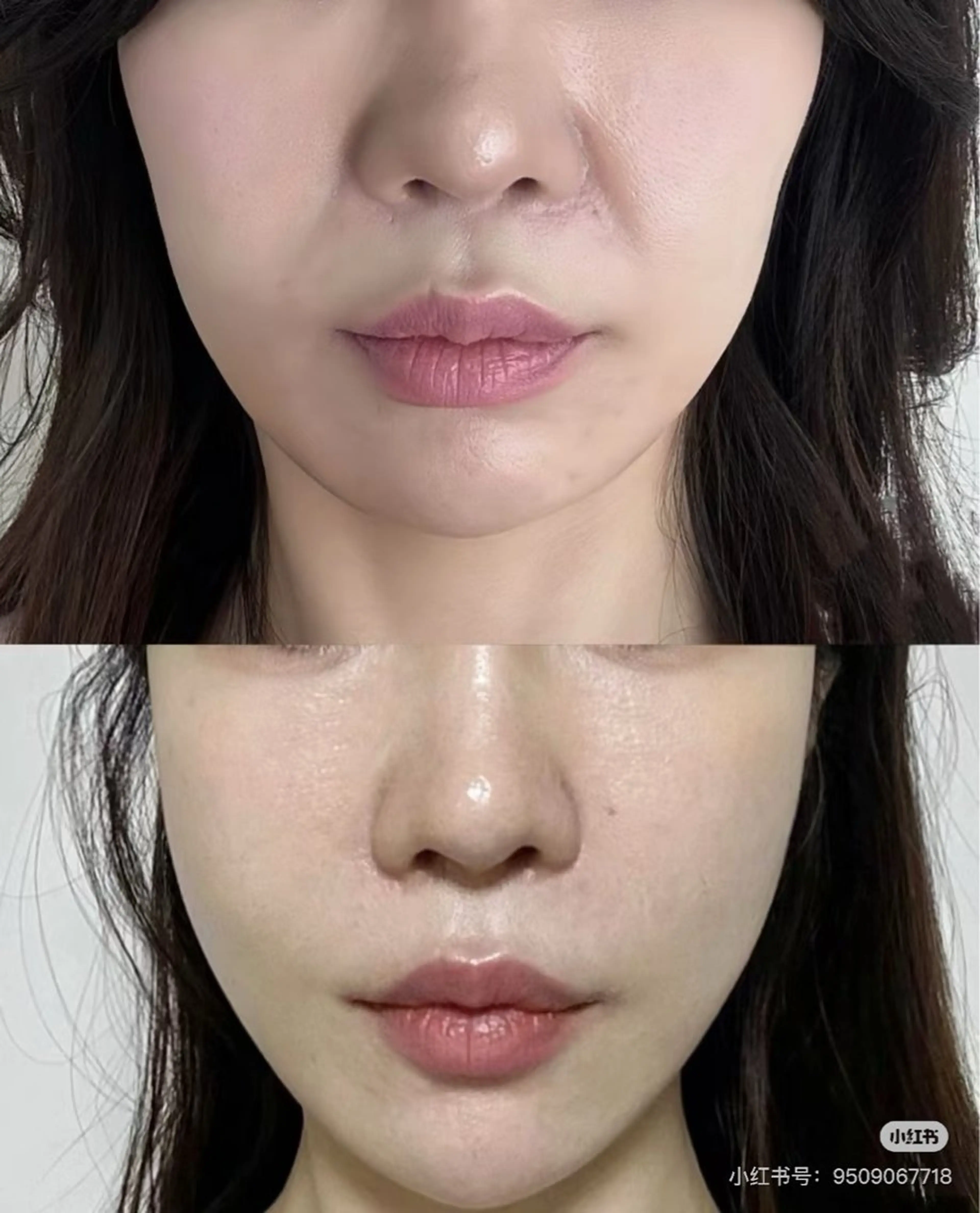 ネイル エステ aliaハーブ水光店 エステティシャン募集のエステ・リラクイメージ