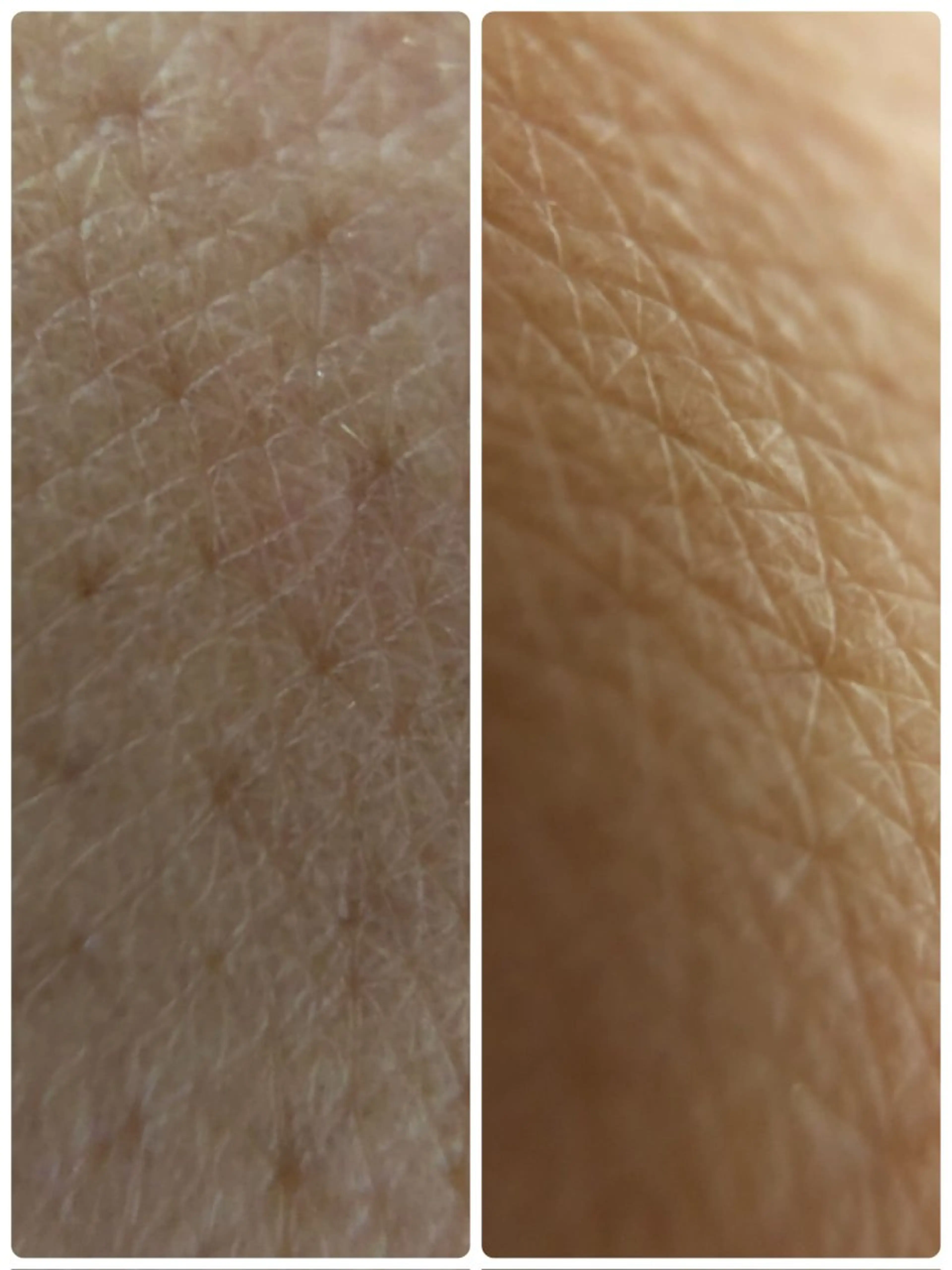 エイジング肌質改善 サロンプレジールのエステ・リラクイメージ