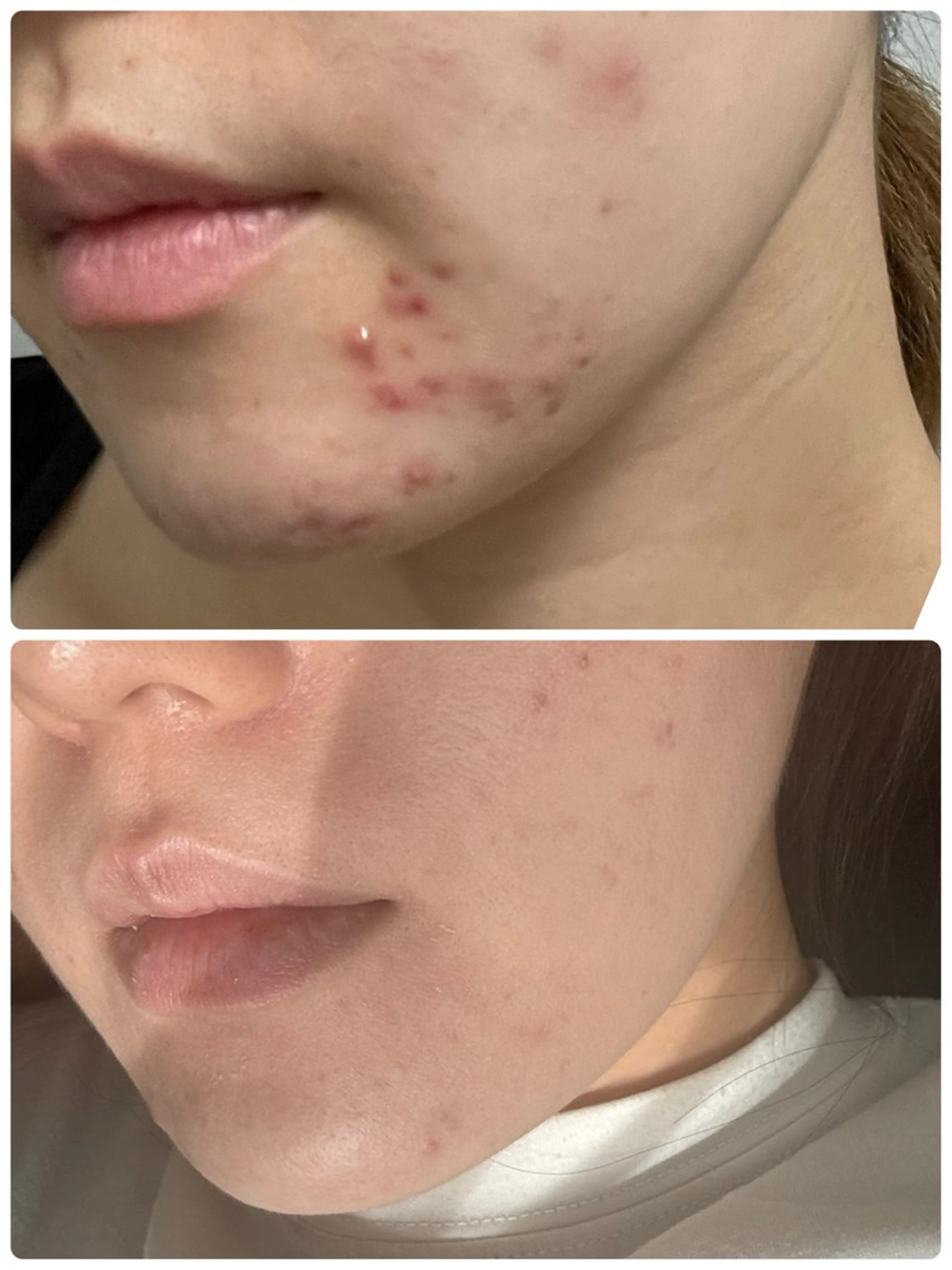 その他 姫路/肌管理/脱毛 Le Cherienのその他イメージ