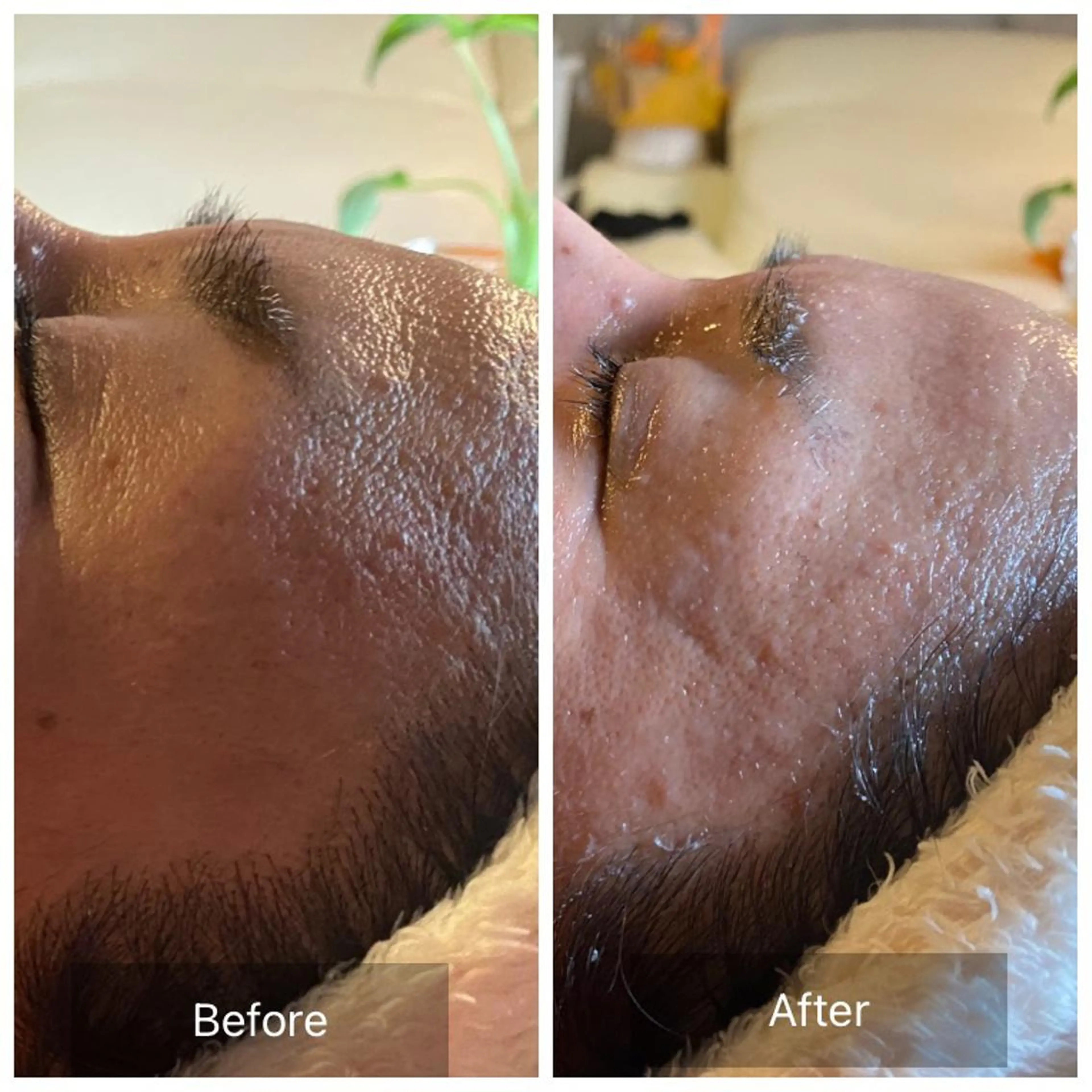 Mandarin Orange所属・毛穴から始める肌メン テマンダリンオレンジのエステ・リラクイメージ