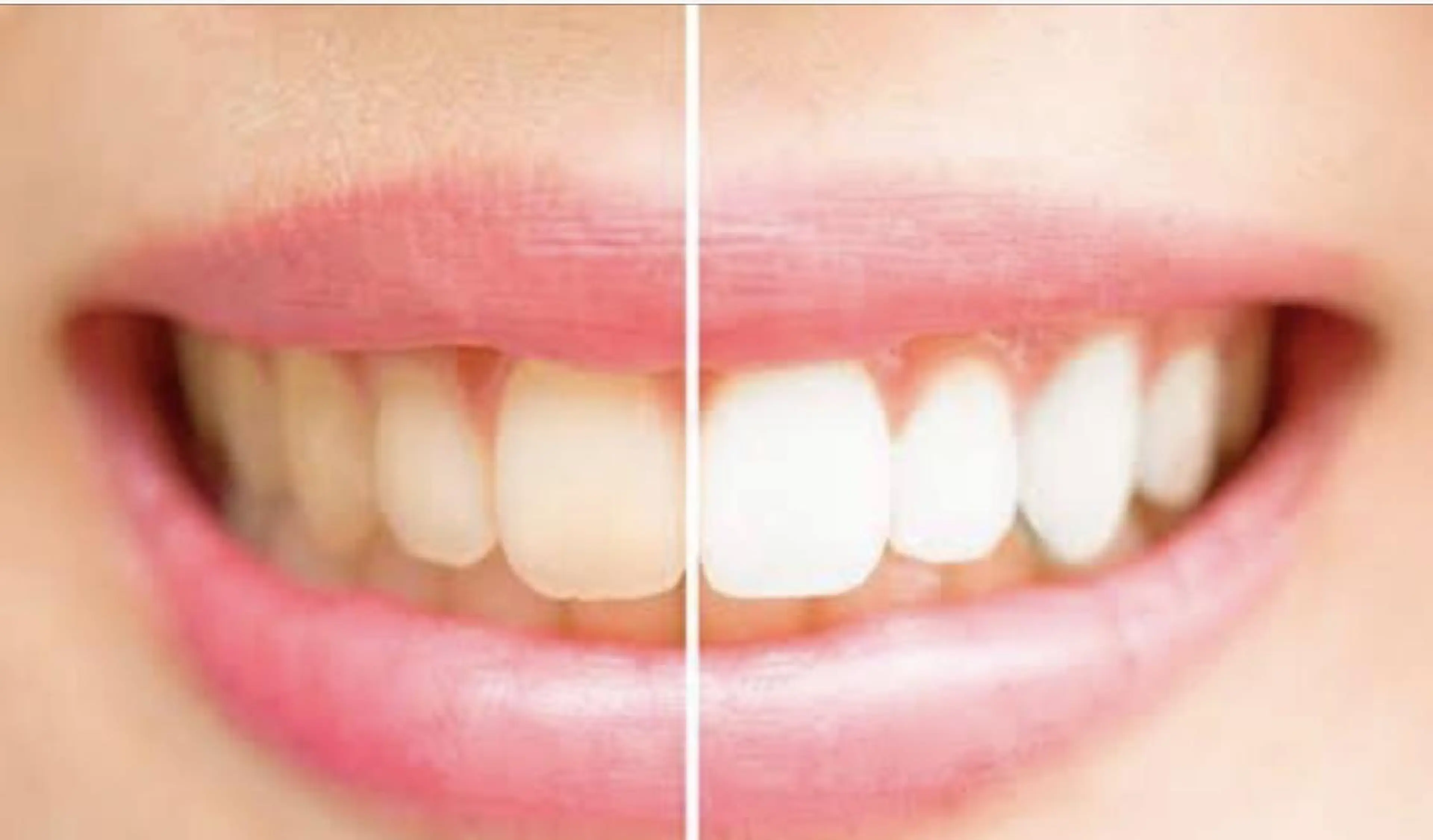 パトラクシェ 銀座店のエステ・リラクイメージ