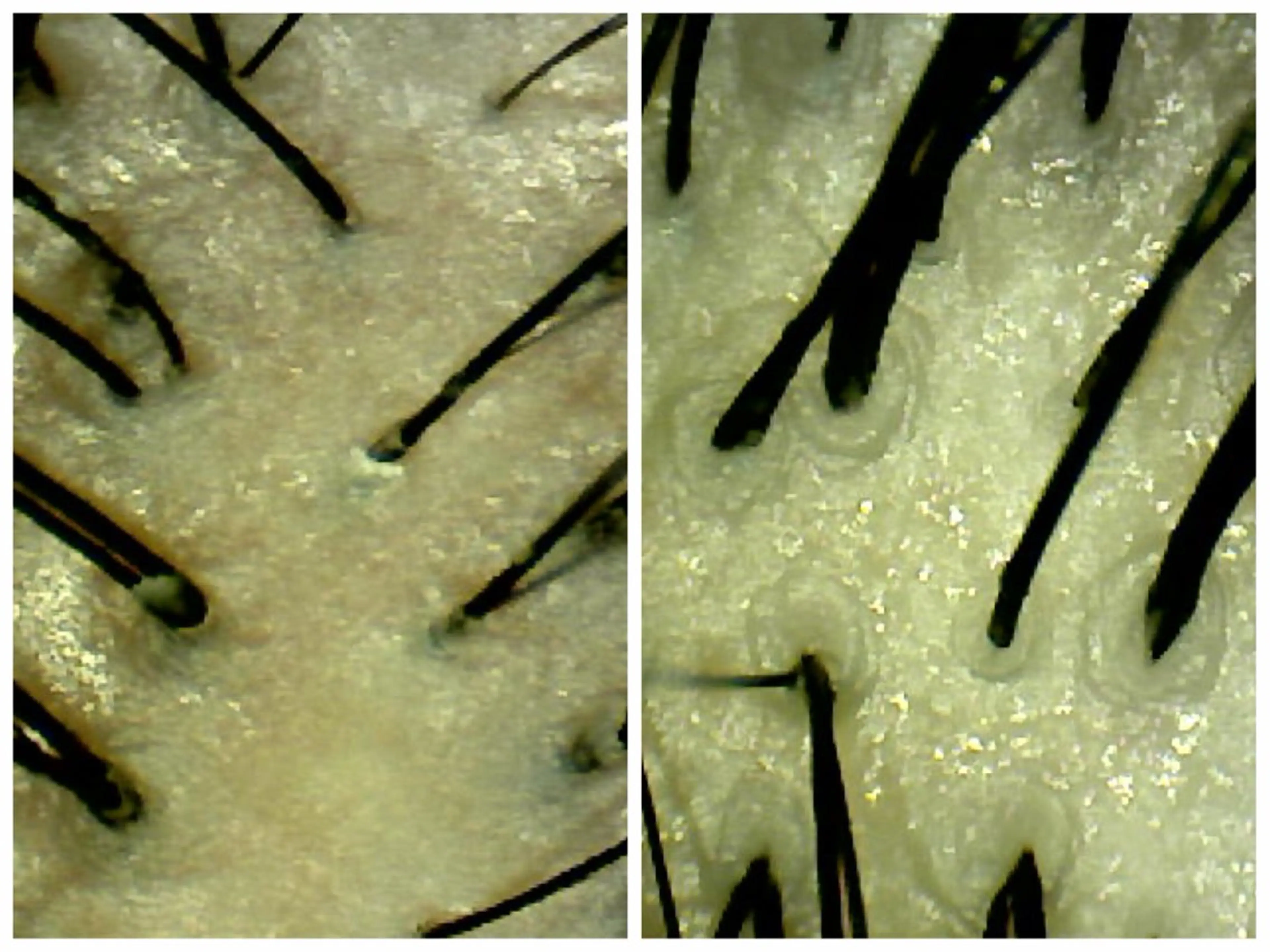 1番人気✨️30分ヘッドスパコースの写真