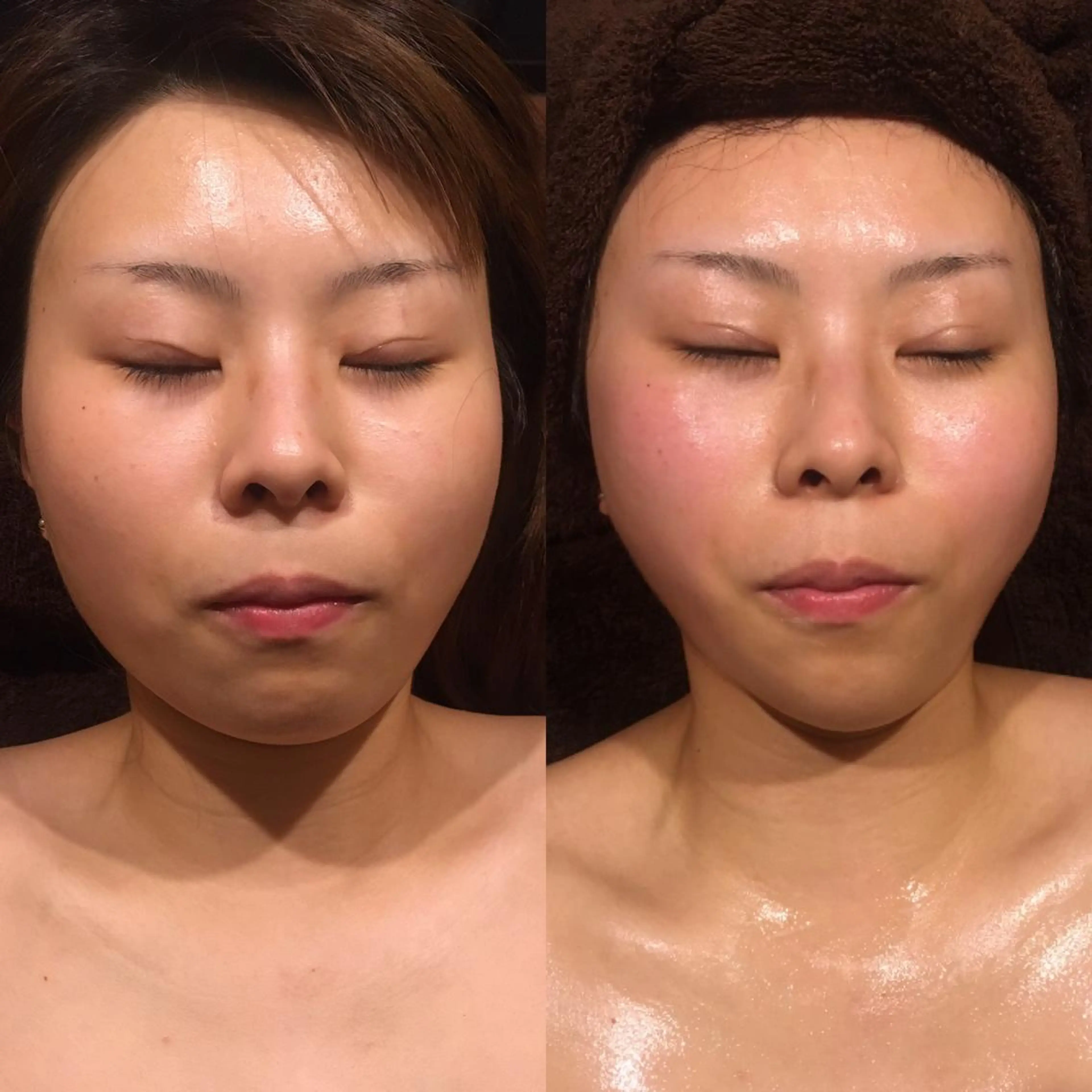 小顔やたるみに特化 💚野瀬可蓮のその他イメージ