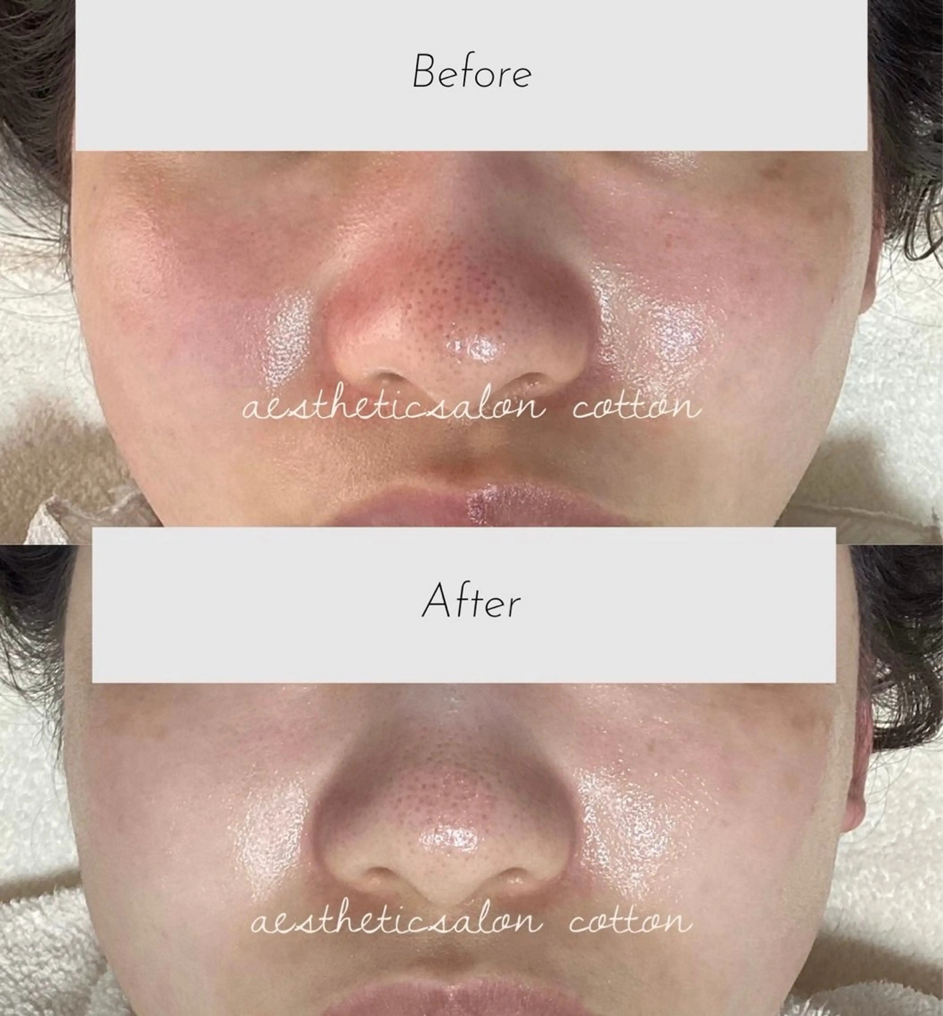 エステ 都度払い 肌質改善専門サロンのエステ・リラクイメージ