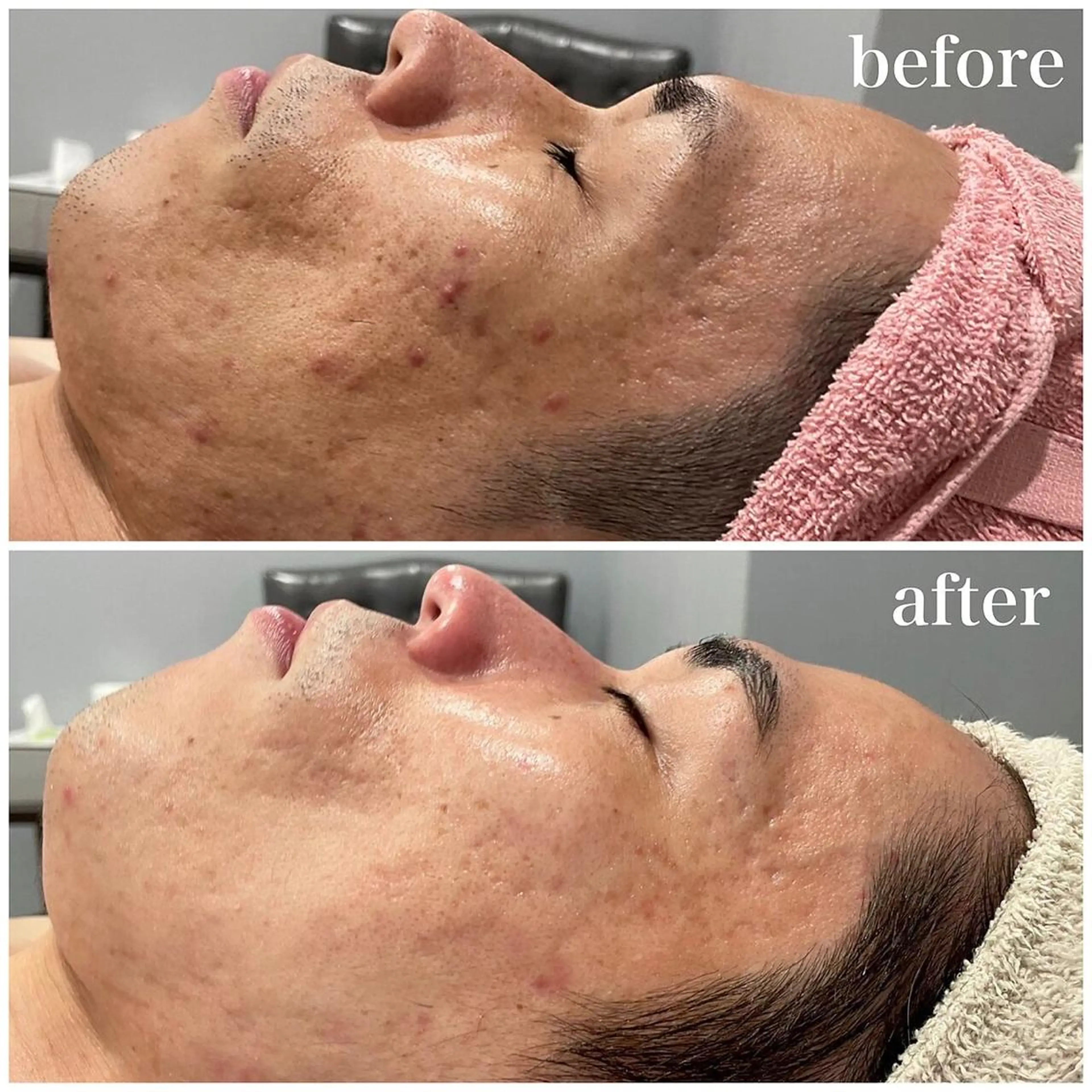 産後/ツヤ肌/子連れ /保育士在籍サロンのエステ・リラクイメージ