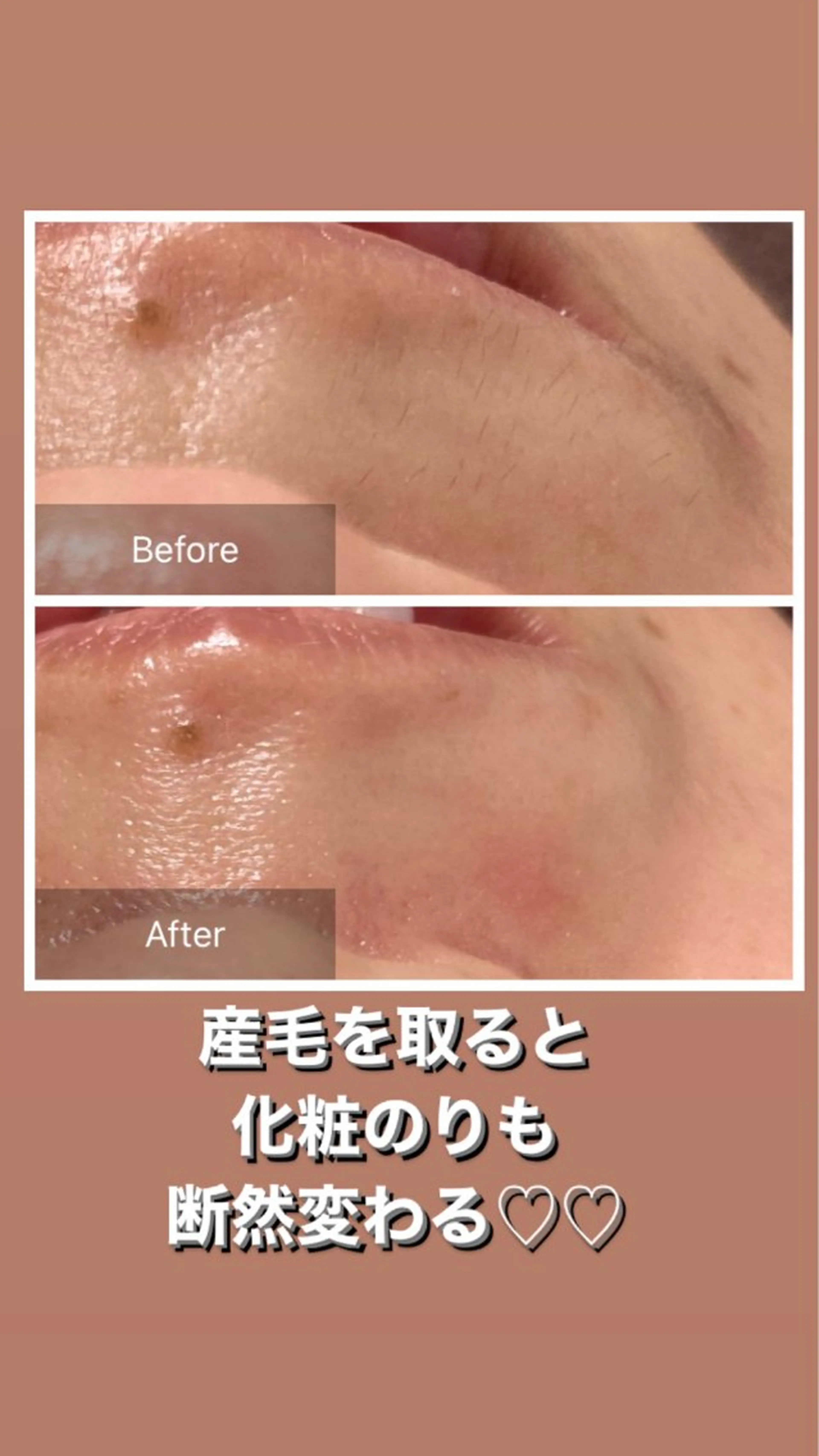 エステ 産毛専門店 Bittoのエステ・リラクイメージ