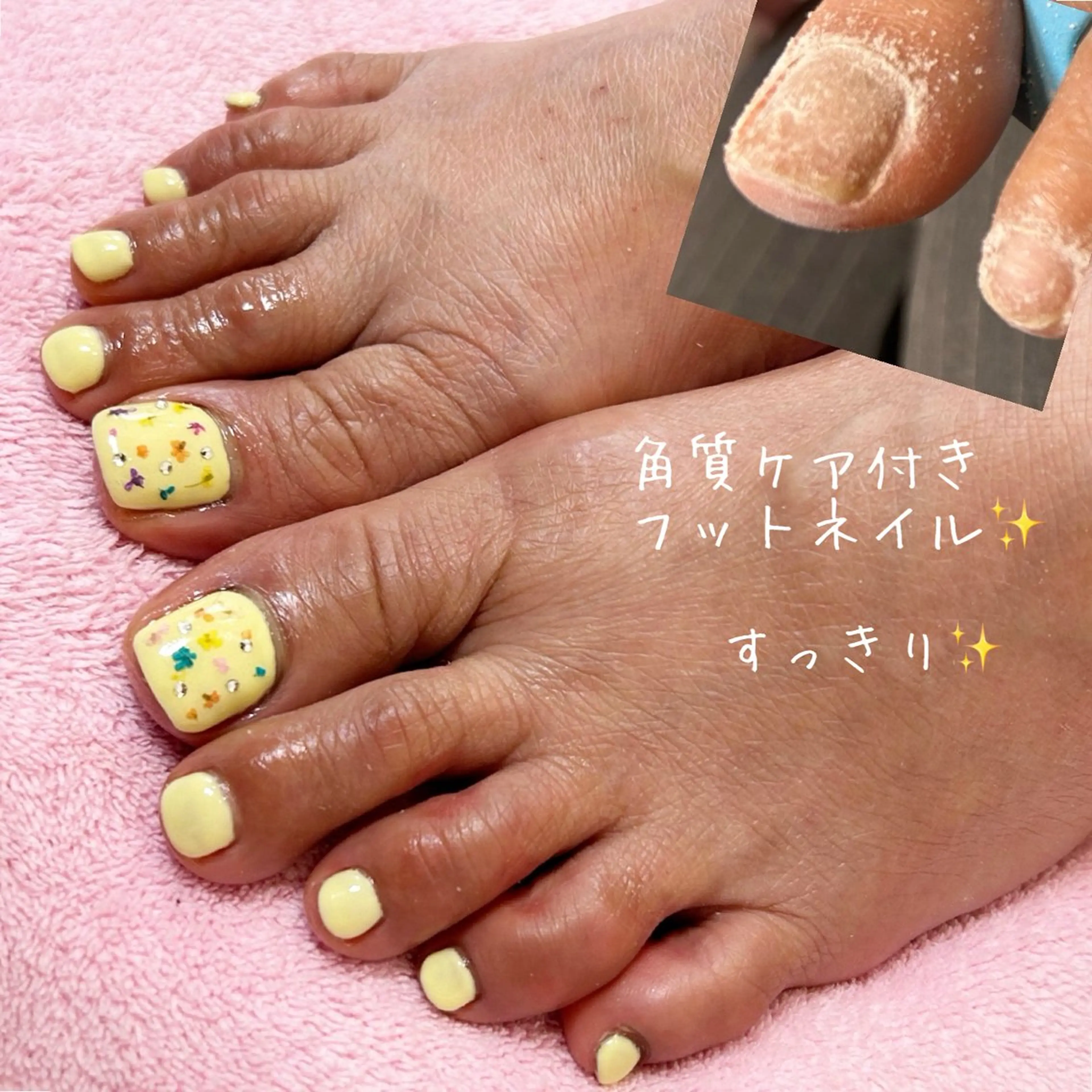 ネイル フットネイル ネイルサロン翼所属・ネイルサロン 翼【仙川4分】のネイルデザイン