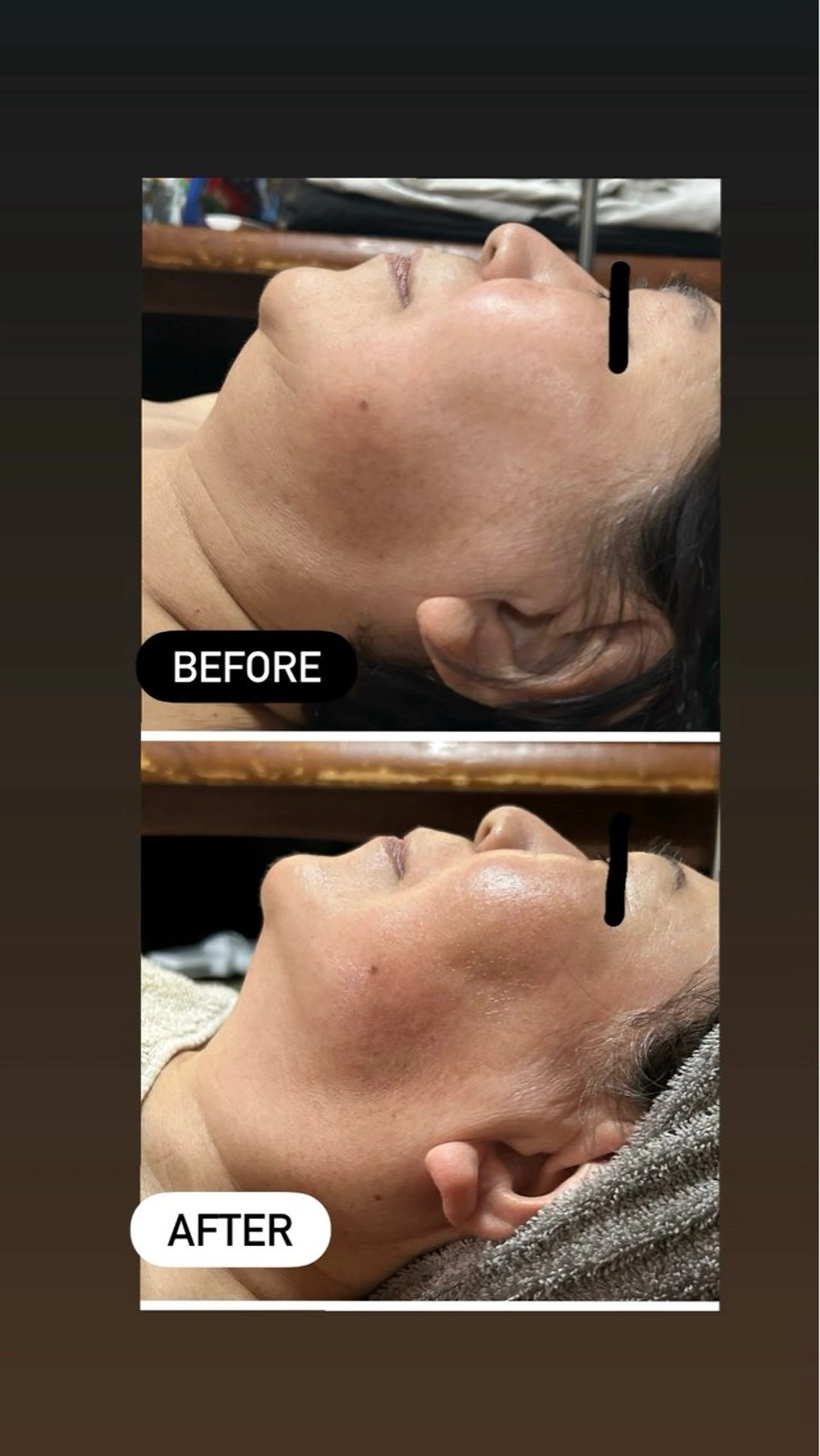 lymph coconのエステ・リラクイメージ