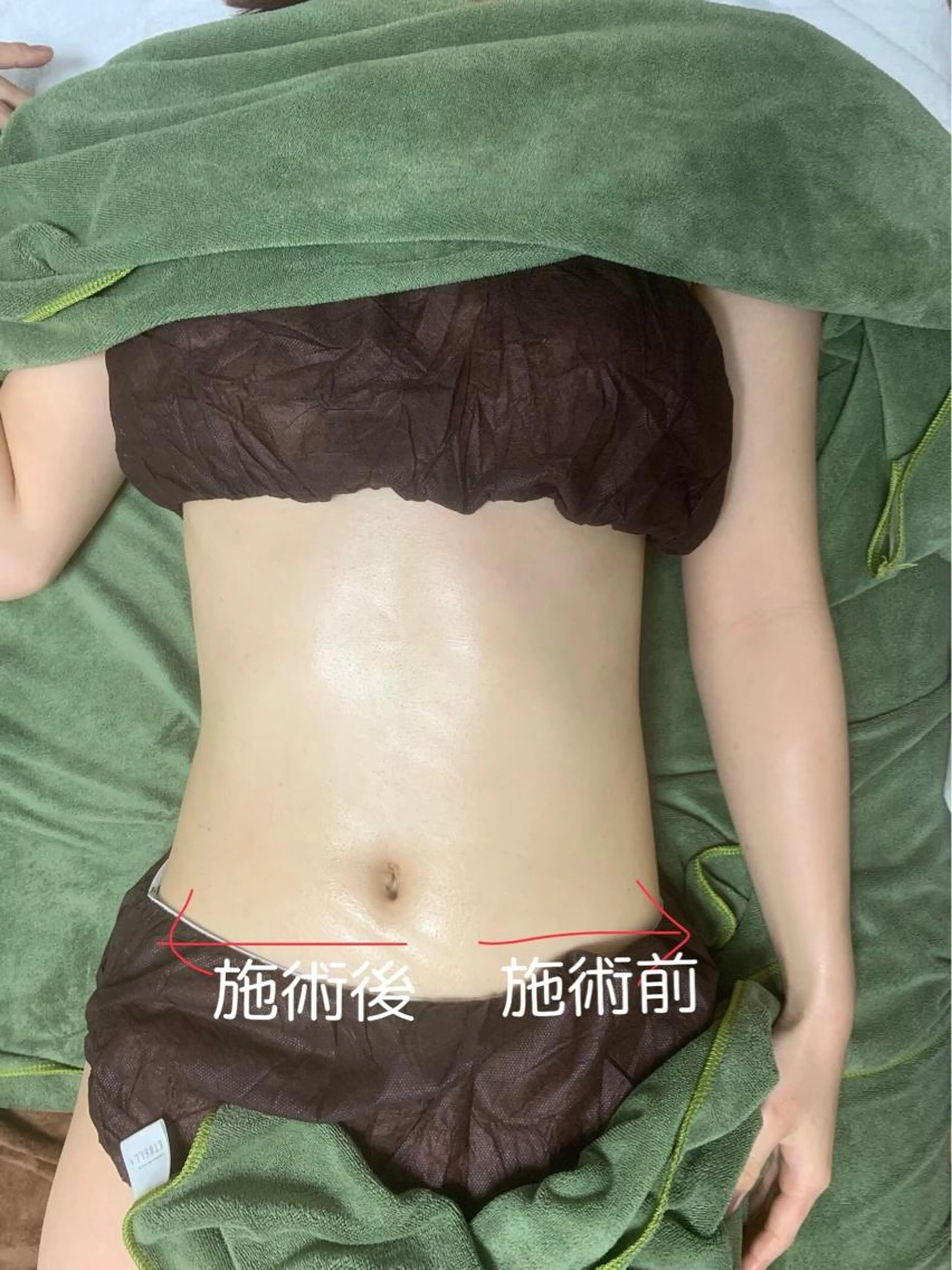 <🌸春キャンペーン🌸自分メンテナンス全身スッキリ!期間限定🌟Body+Face90min🌟フェイシャルパック付>の写真