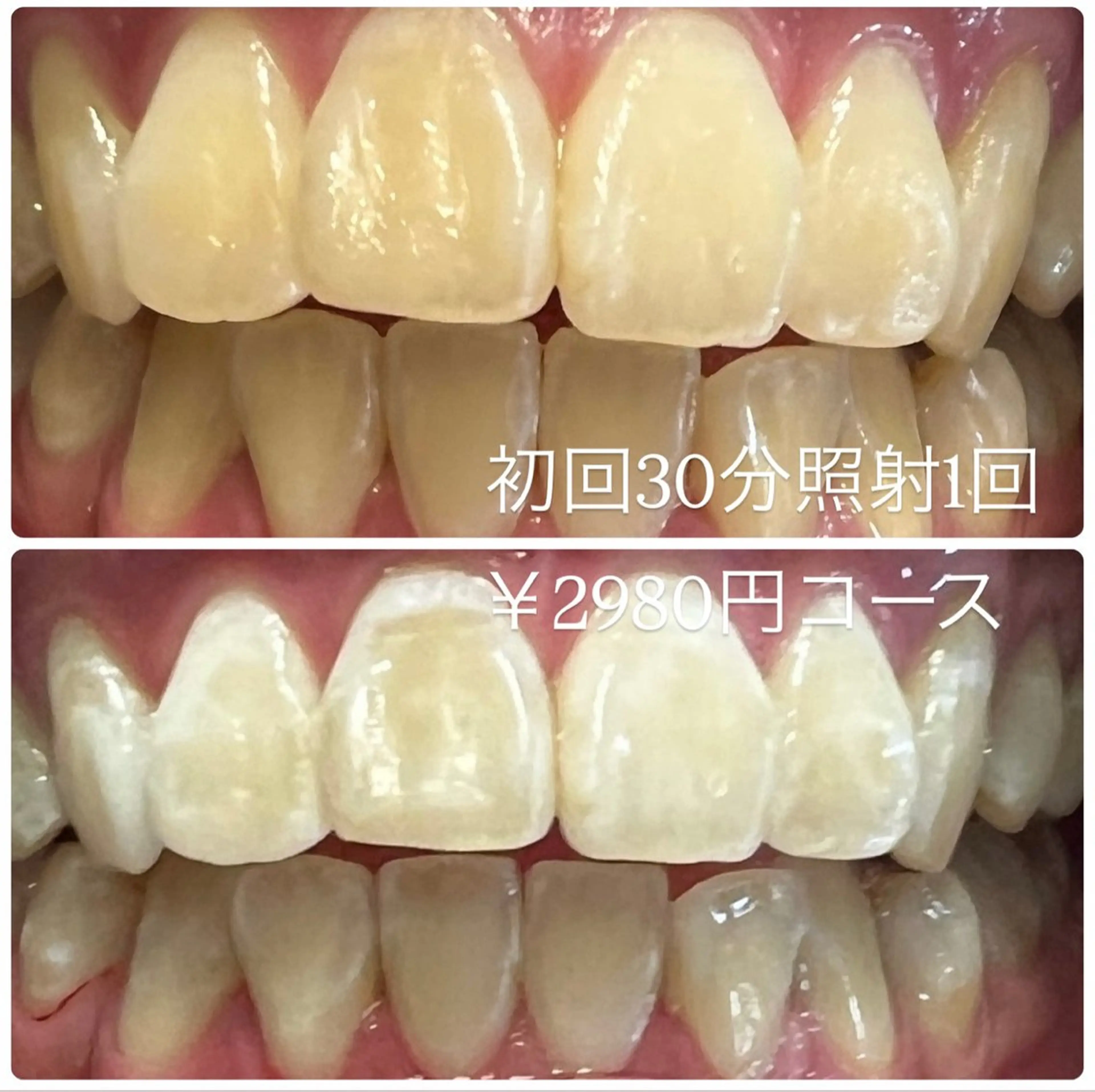 その他 ホワイトニングルーム 横浜店のその他イメージ