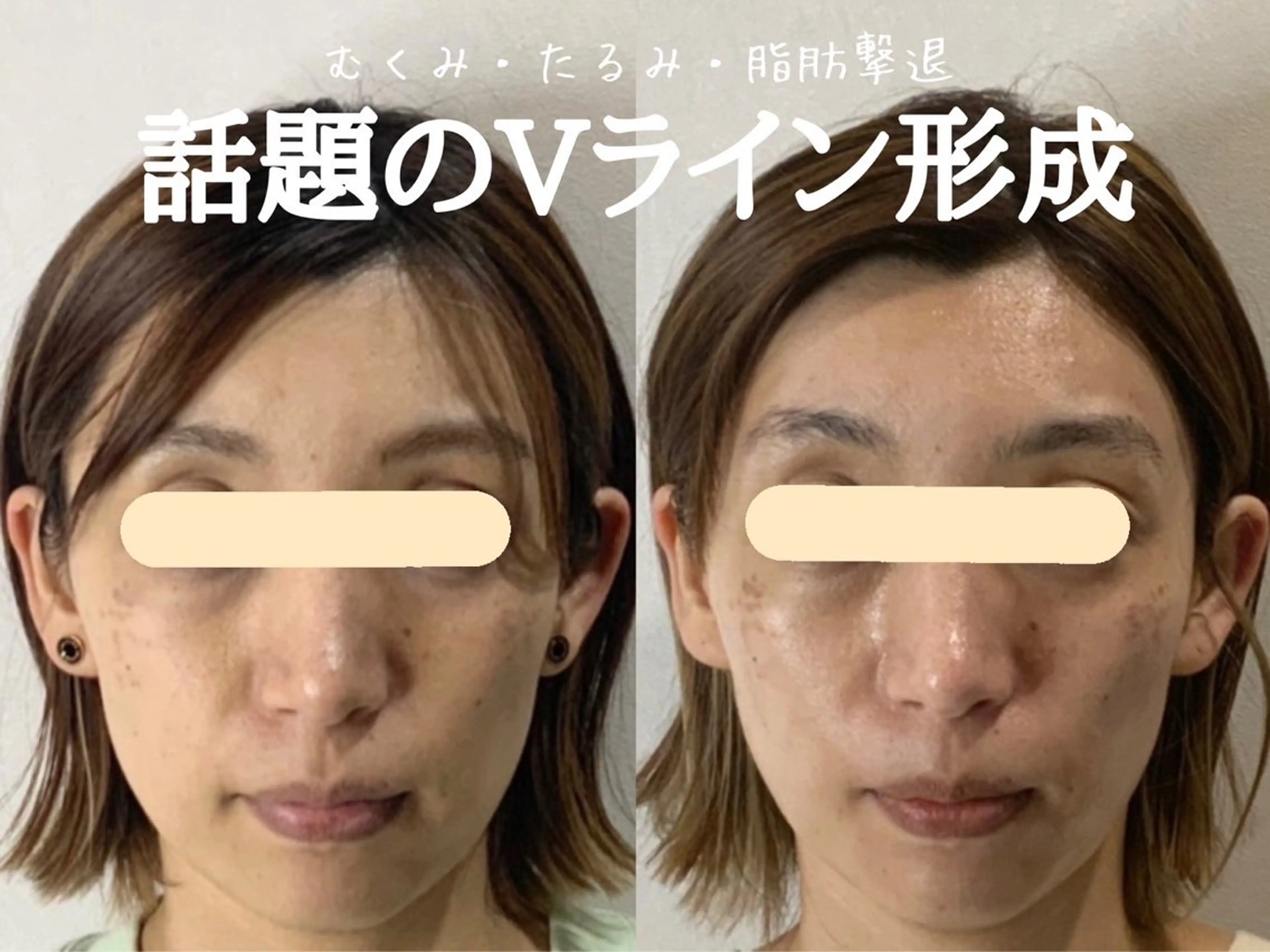 エステ リラク 最速小顔・肌質管理 espoirマキのエステ・リラクイメージ