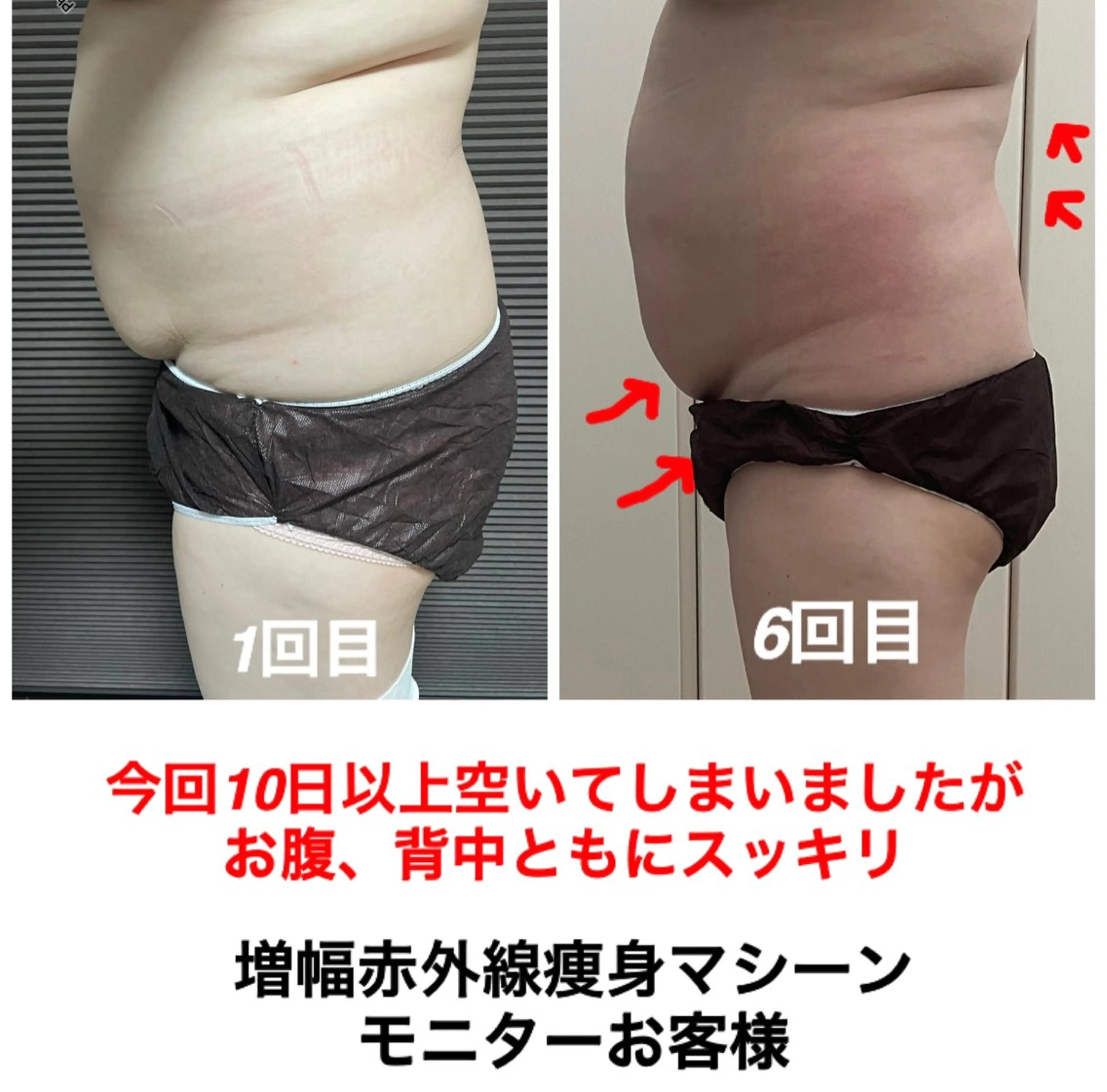 エステ ネイル・エステサロン UILANIのネイルデザイン