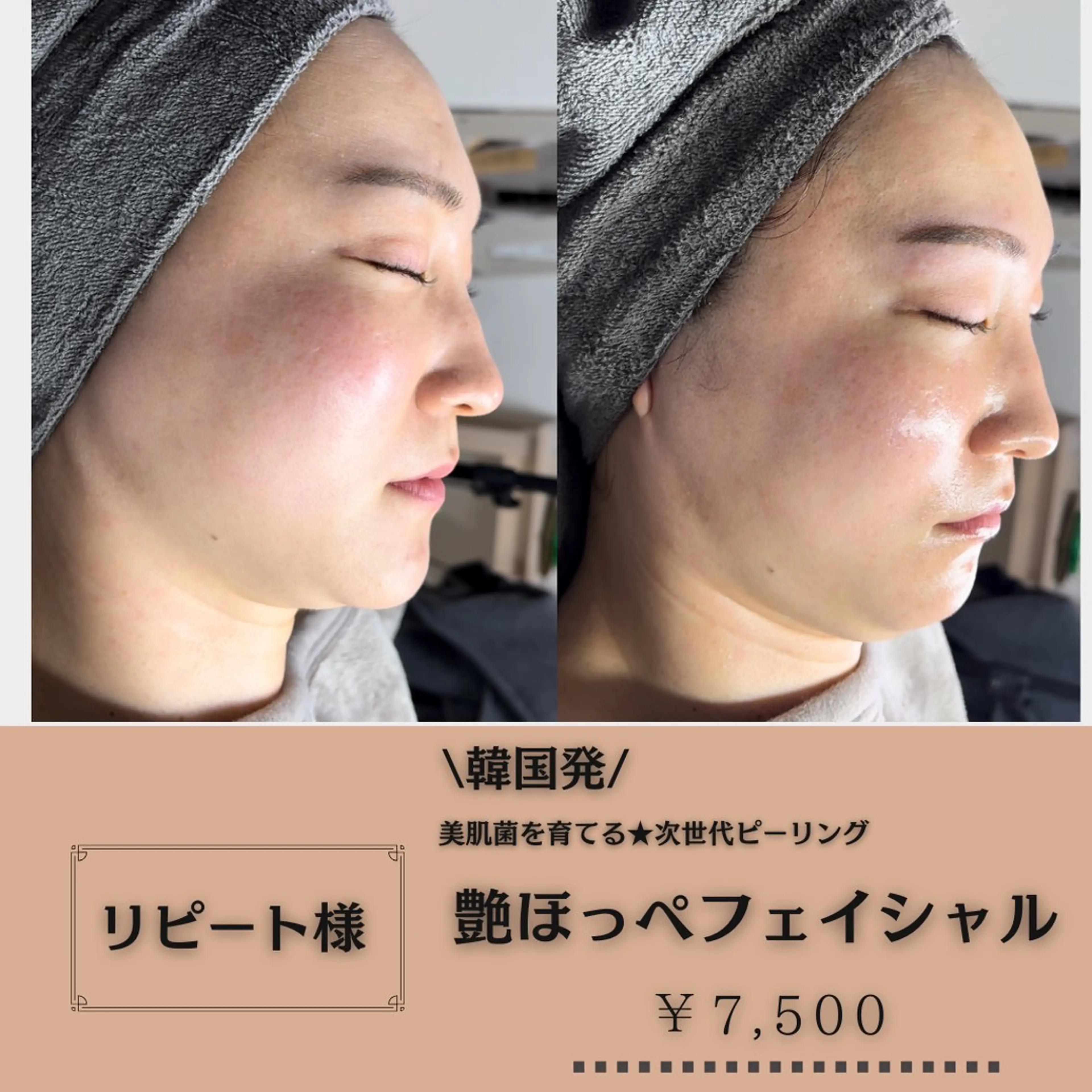 HANAFUSA YURIKAのその他イメージ