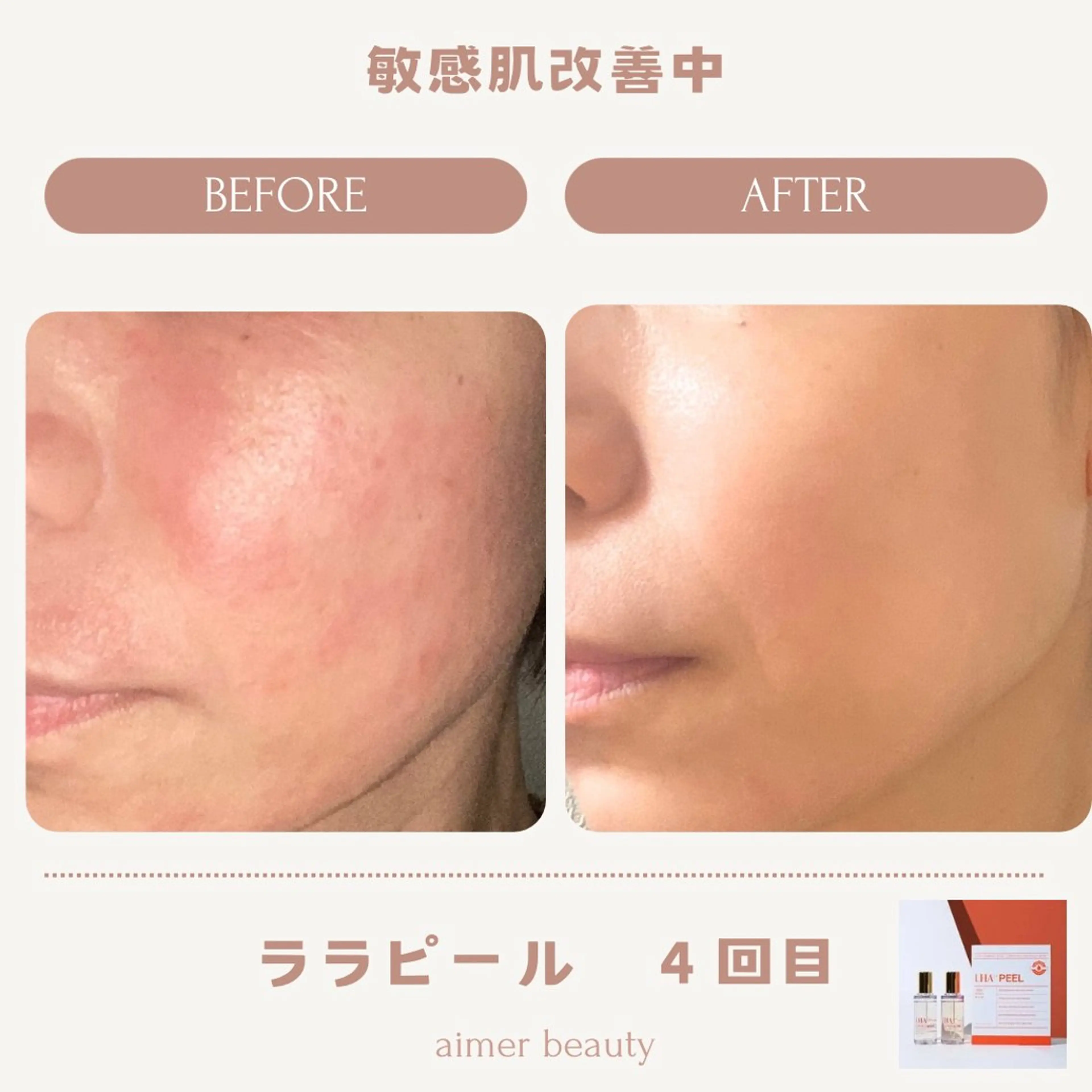 エステ aimer beautyのエステ・リラクイメージ