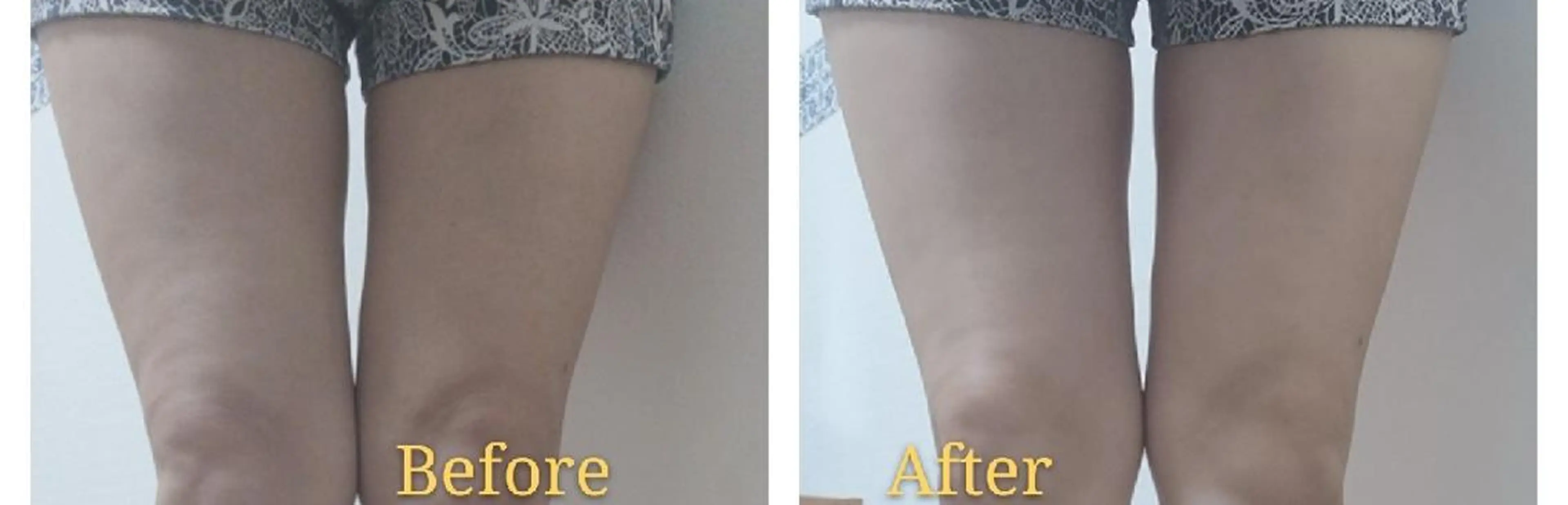 🅖🅤🅩🅔🅛 salonのエステ・リラクイメージ