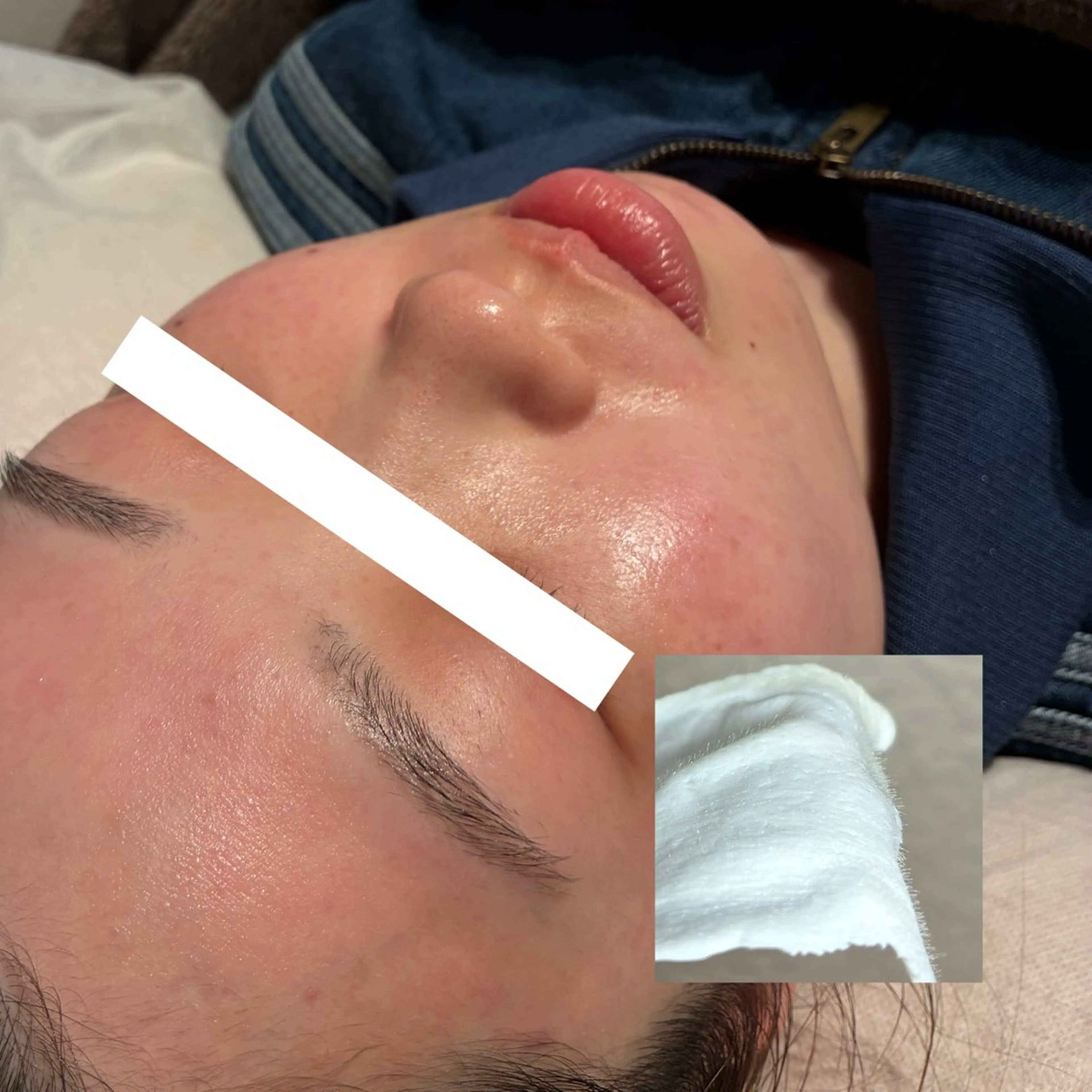 脱毛 Erika komorebi_のエステ・リラクイメージ