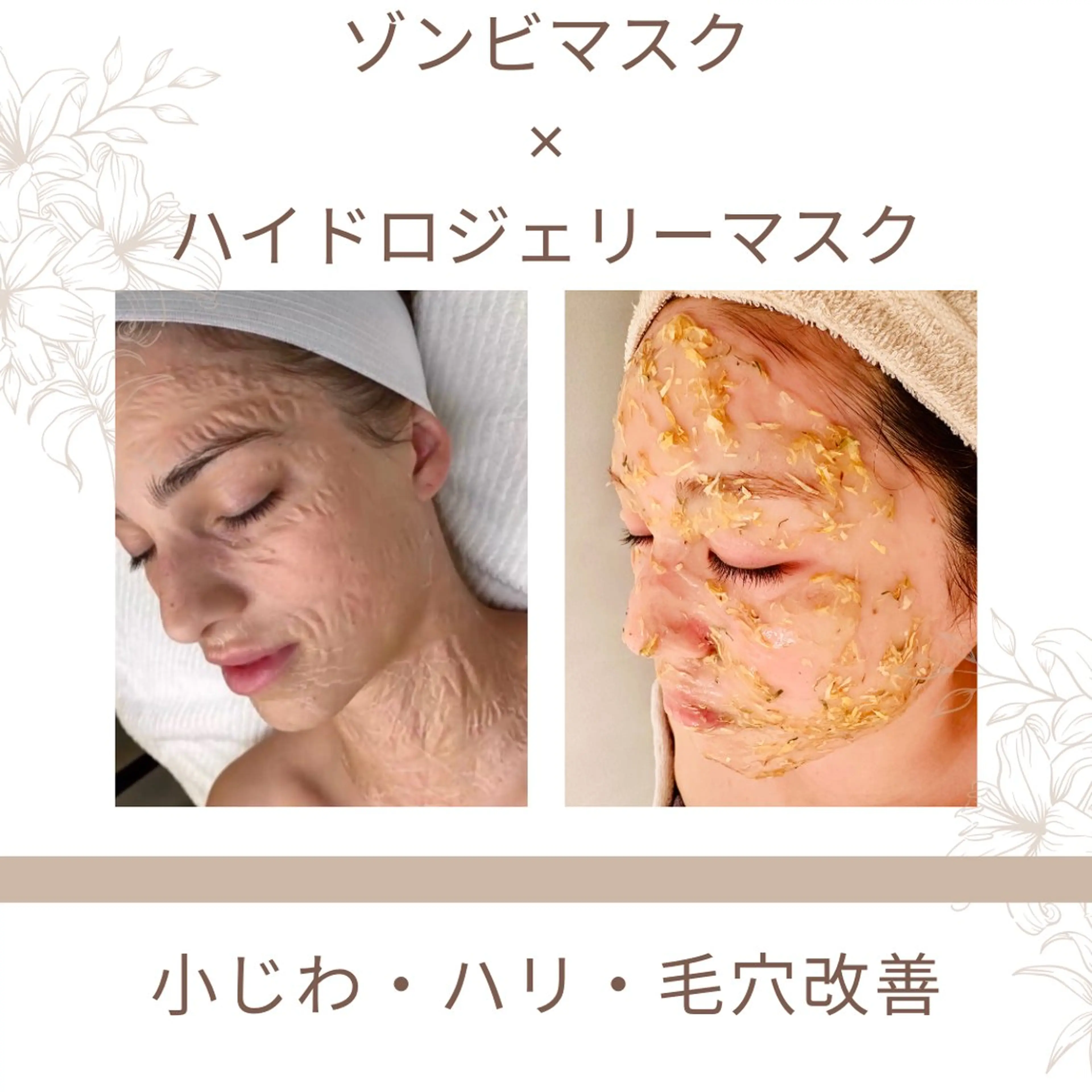 Lily luce 美骨小顔矯正のその他イメージ