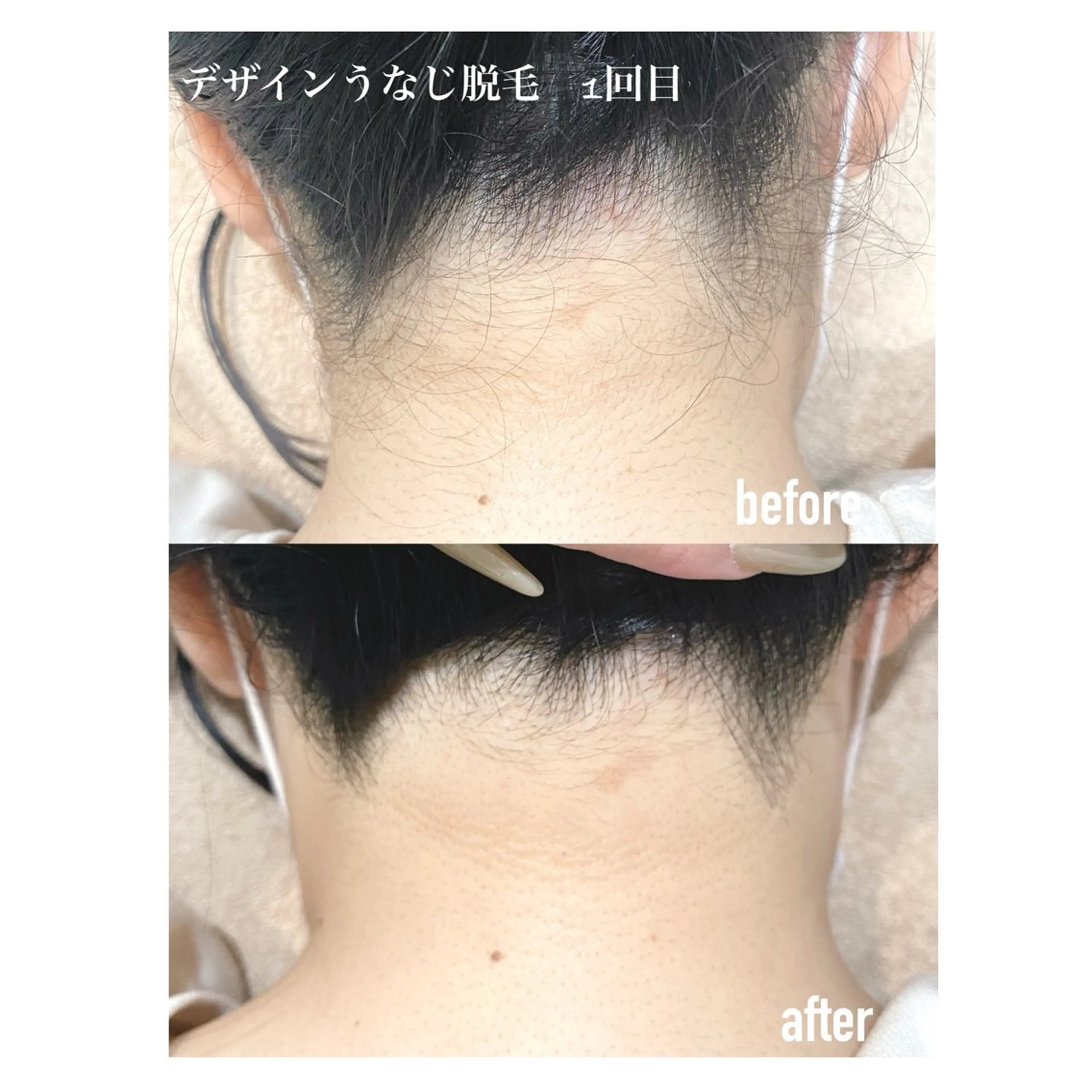 脱毛 M's Style NAIL BARのネイルデザイン