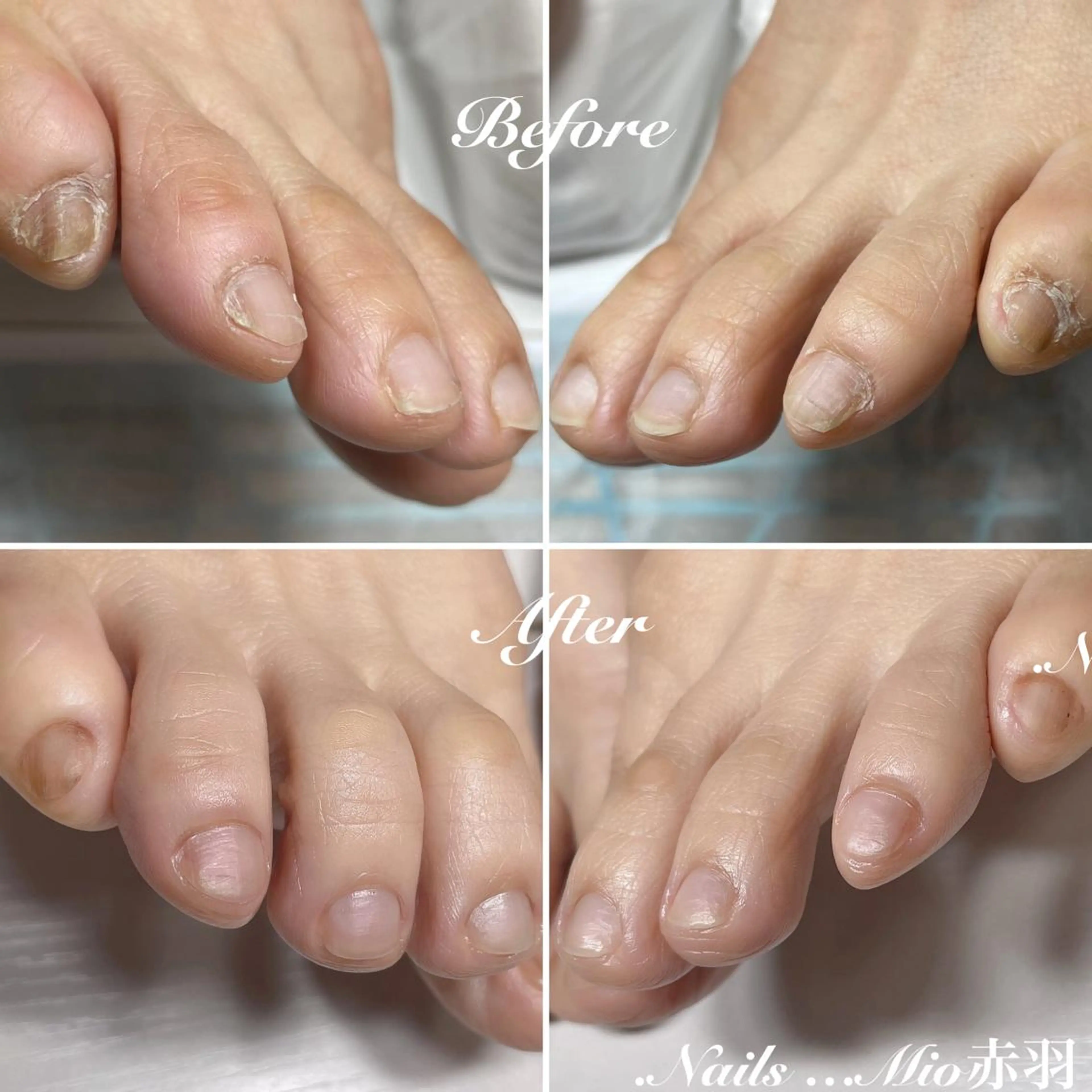 ネイル フットネイル .Nails Mio 赤羽西ネイルサロンのネイルデザイン