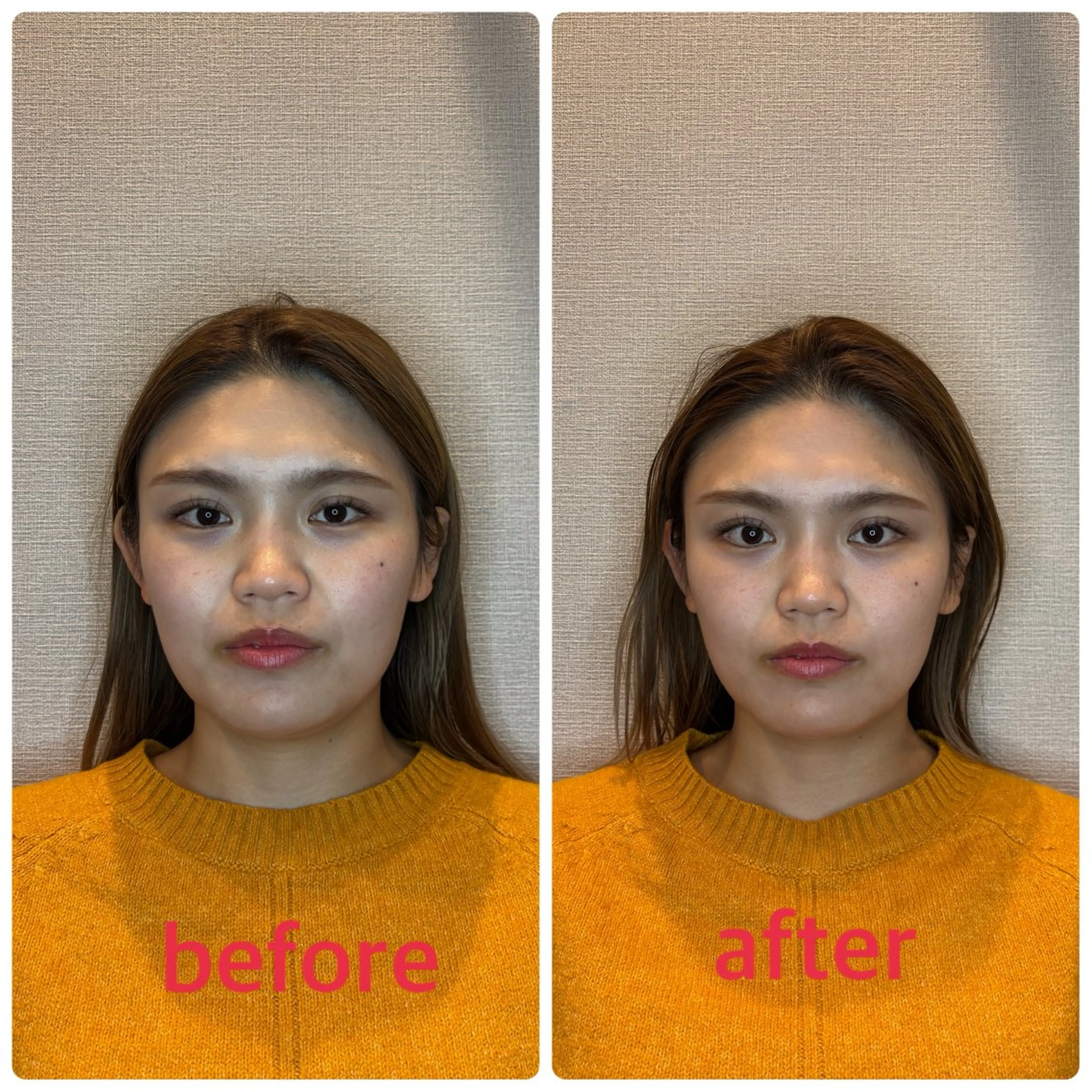 エステ リラク 小林整骨院本町 美容鍼roomのエステ・リラクイメージ