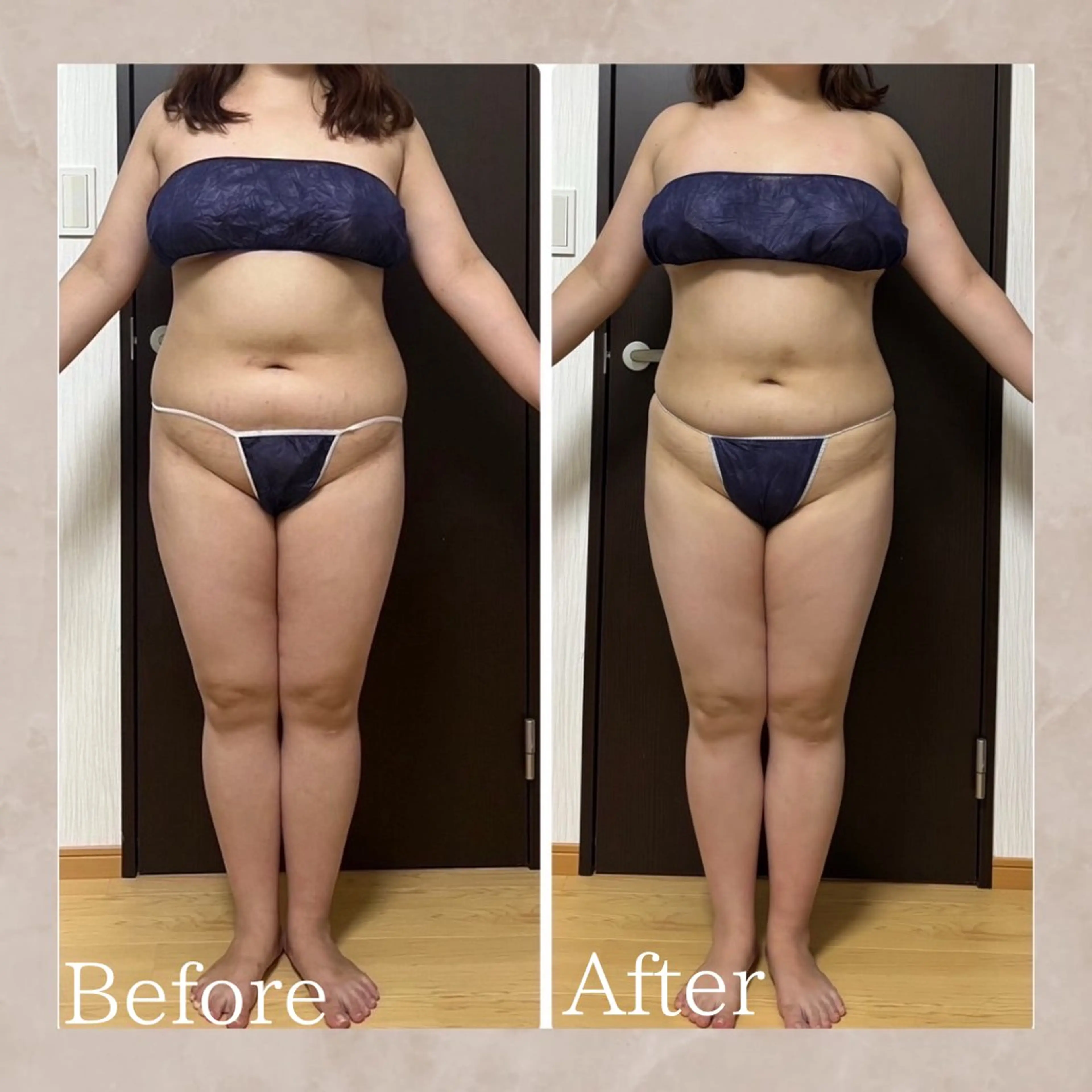 🆕リニューアルオープン特別価格❣️痩身エステ全身ショートコース🦵の写真