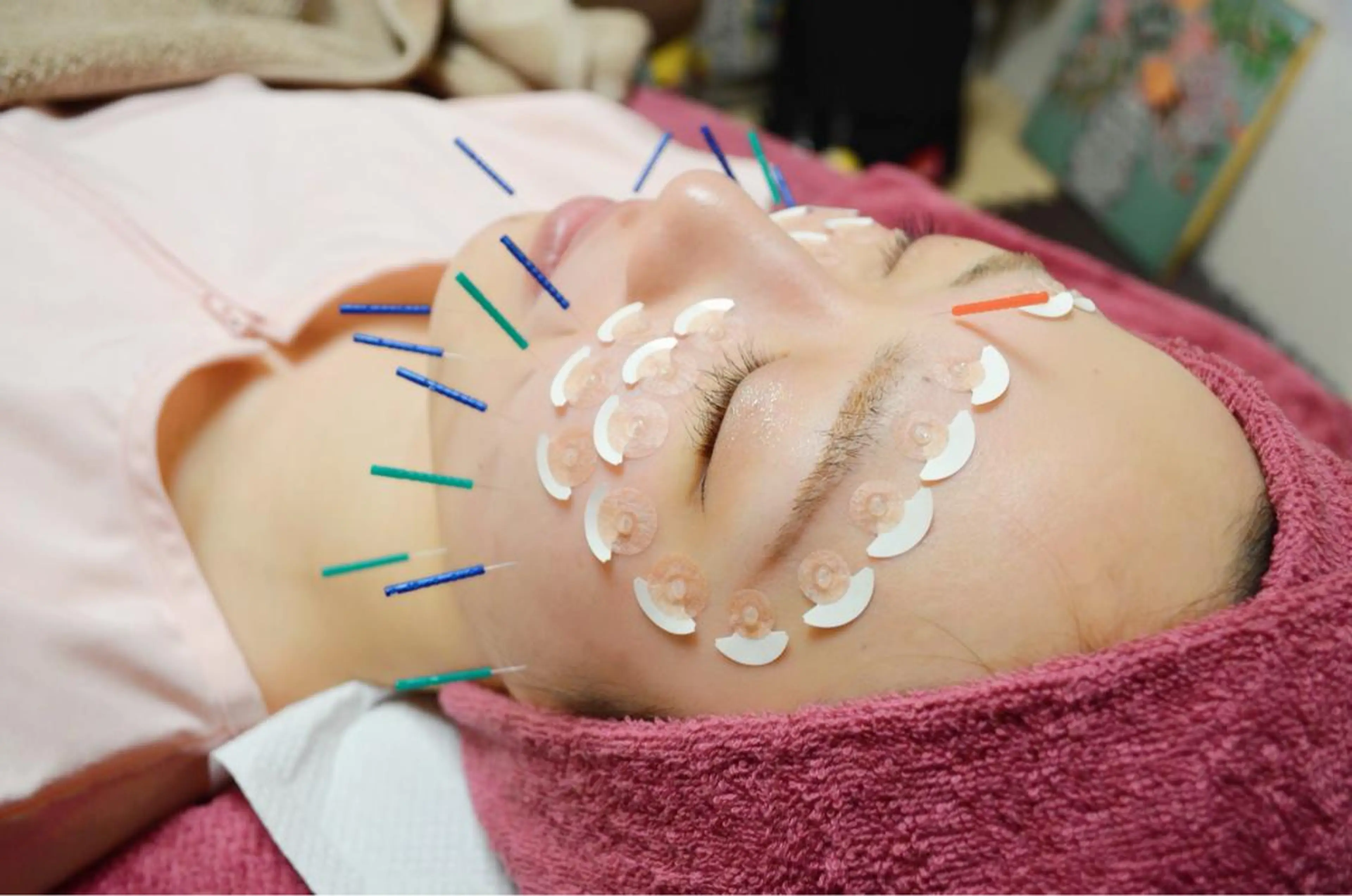 美容鍼灸女性専用 りんご鍼灸治療院のその他イメージ