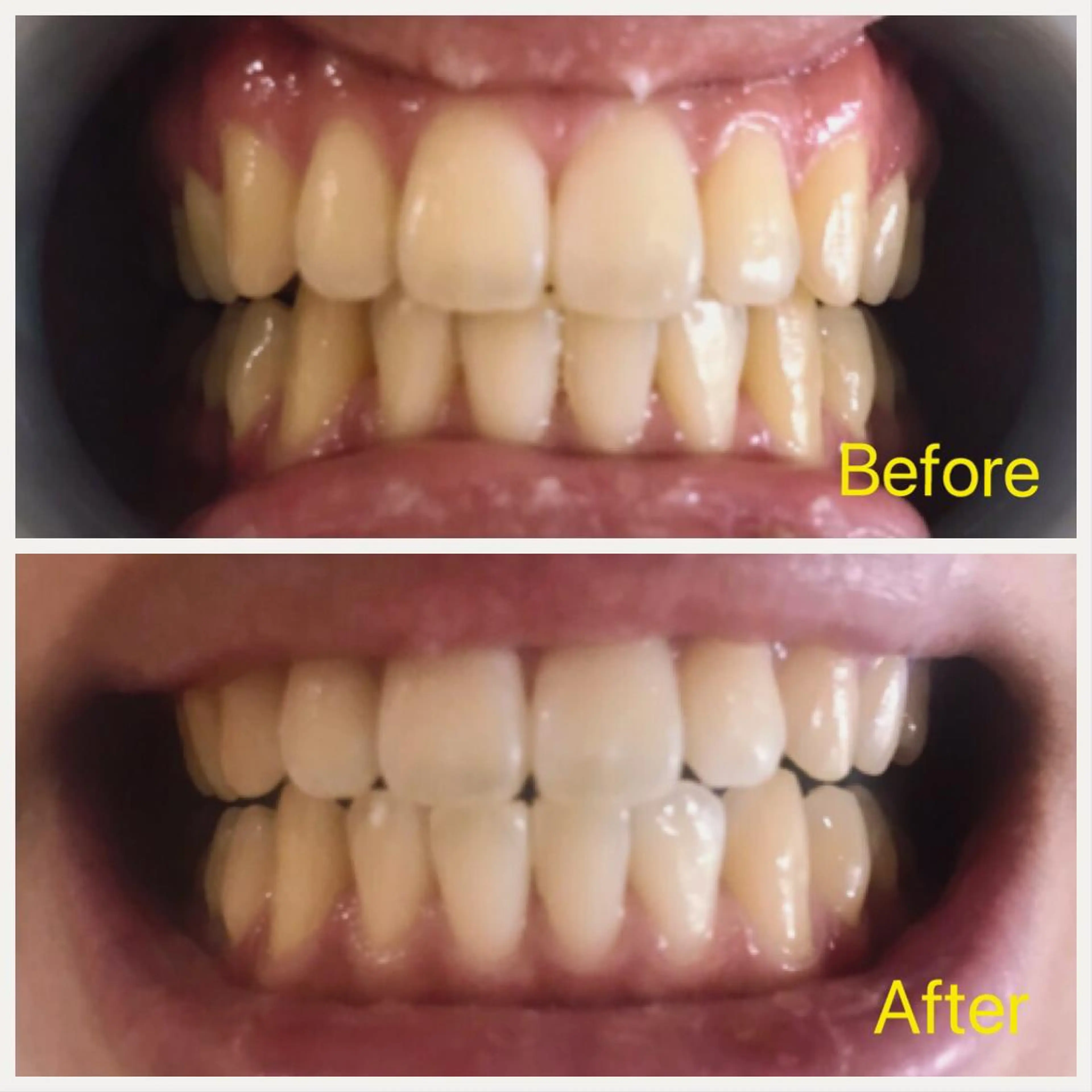 Ｍ渋谷 ホワイトニングのエステ・リラクイメージ