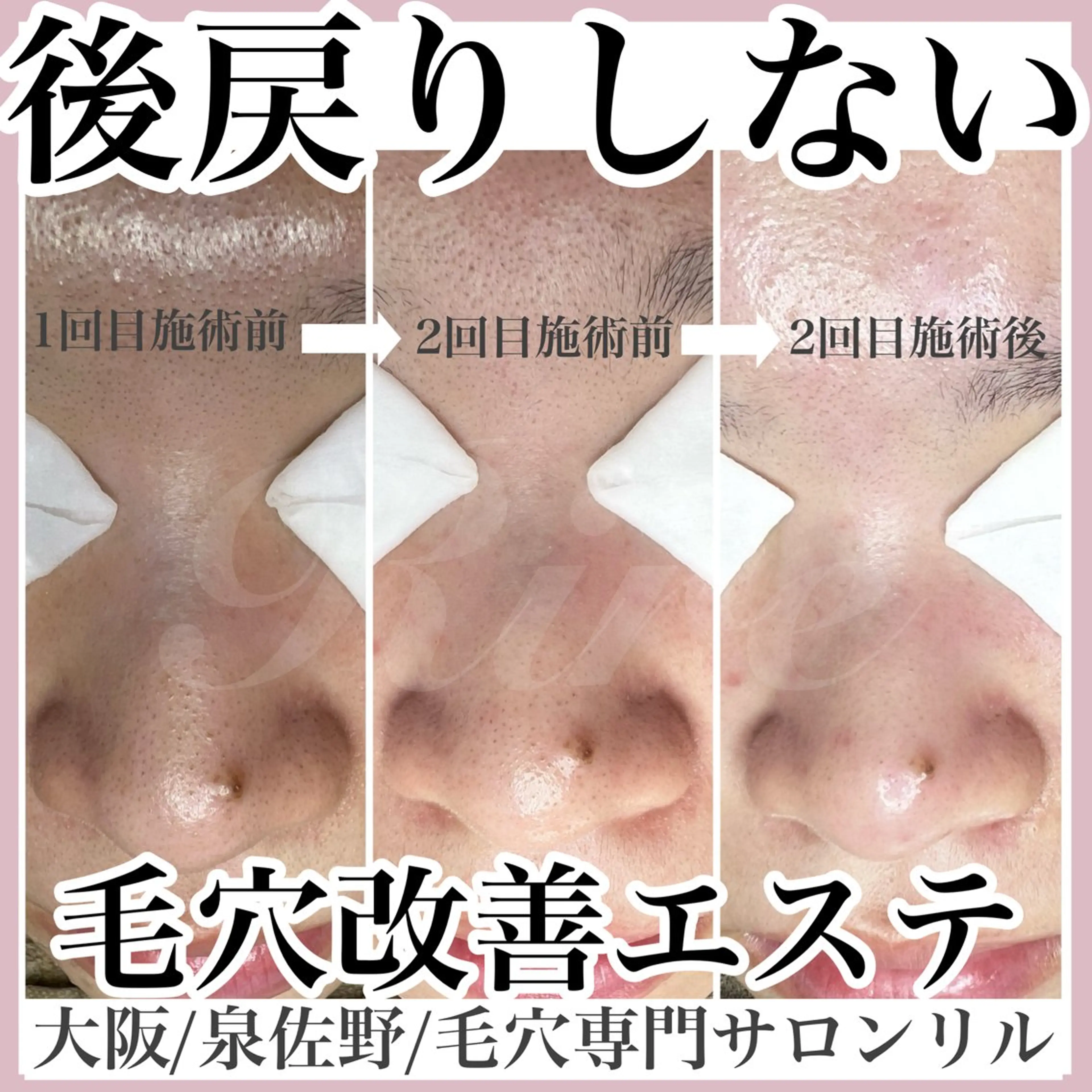 エステ 隅田 都布子のマツエク・マツパデザイン