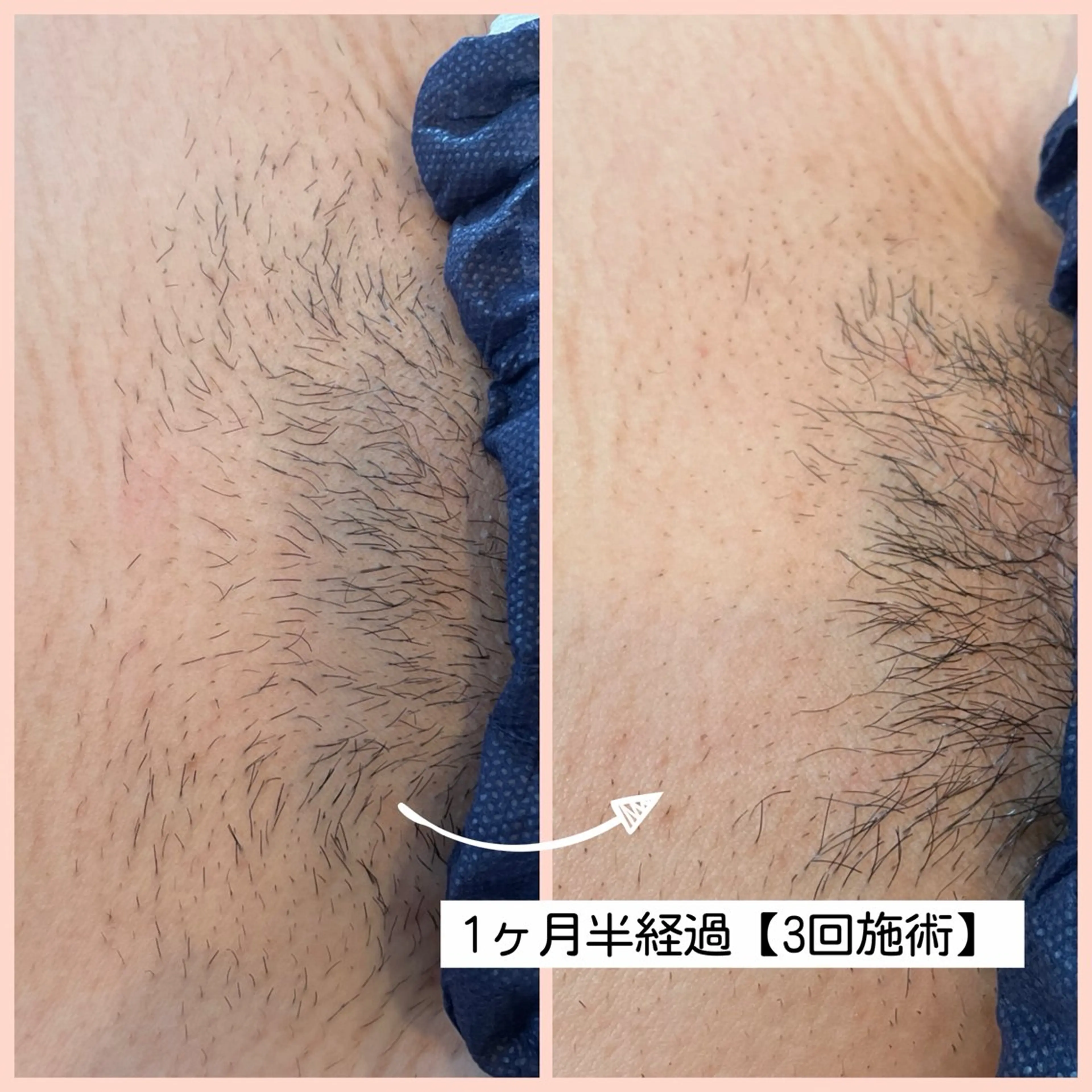 脱毛 private脱毛salon HALE所属・private脱毛 salon HALEのエステ・リラクイメージ